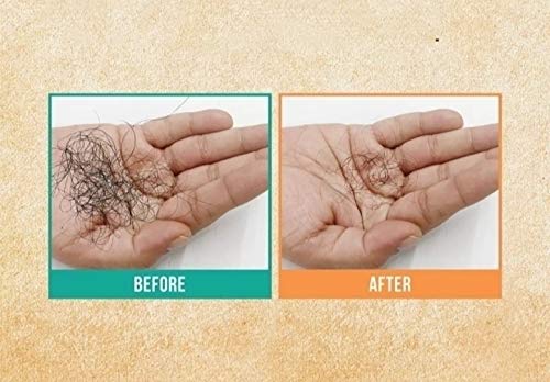 Anamika Natural Onion Hair Oil for Hair Growth & Repair - 100ml Handmade Hair Treatment for Dry, Damaged Hair - Perfect for Daily Scalp Massage & Night Hair Care Routine