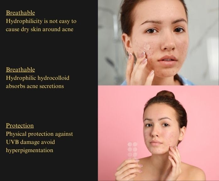 Acne Pimple Patches with Collagen & Vitamin C - Salicylic Acid Hydrocolloid Spot Treatment for Face (8mm & 12mm, 36 Count) | Organic, Sulfate-Free, Invisible | Perfect for Overnight Acne Care & Daily Blemish Cover