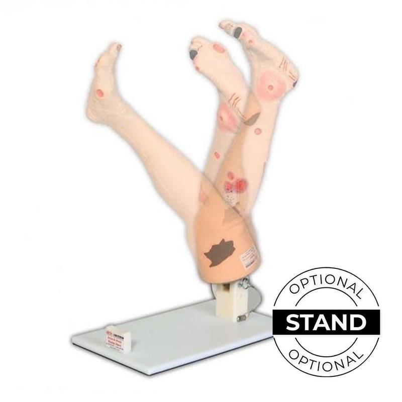 Adjustable Leg Support Stand for Vinnie & Annie - Orthopedic Leg Elevation Pillow for Circulation & Recovery - Perfect for Post-Surgery, Bed Rest & Home Comfort