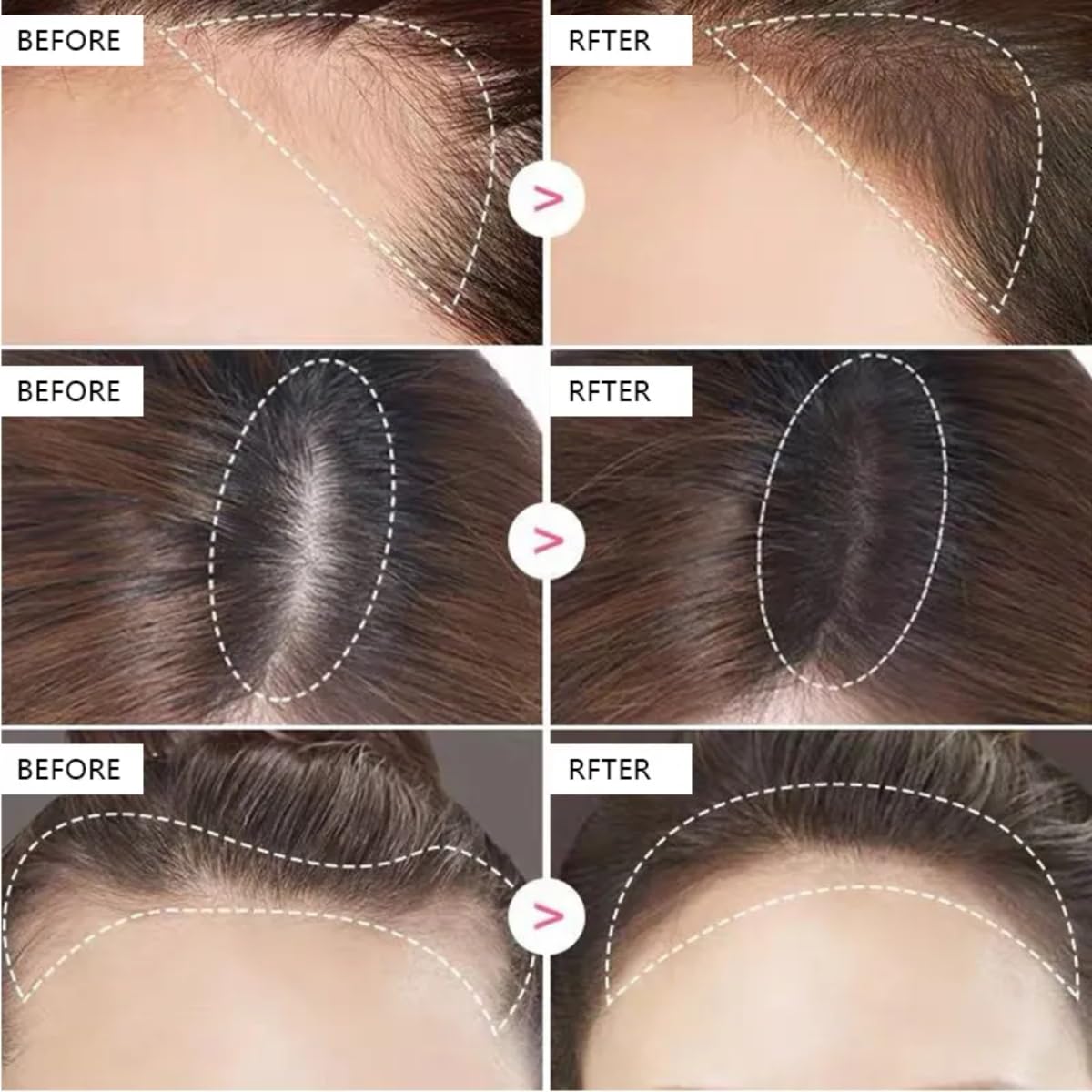 Hairline Shadow Powder for Instant Hair Coverage - Coffee Brown Hair Root Touch Up & Dye Makeup (1 Count) | Perfect for Bald Spots, Thinning Hair & Natural-Looking Hairline Enhancement