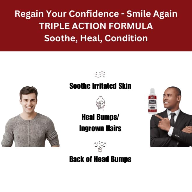 BUMP TERMINATOR - Best Razor Bumps & Ingrown Hair Treatment for Men & Women | Prevents & Soothes Bikini Bumps, Back of Head Bumps | 4 oz | Perfect for Post-Shave Care & Sensitive Skin Relief