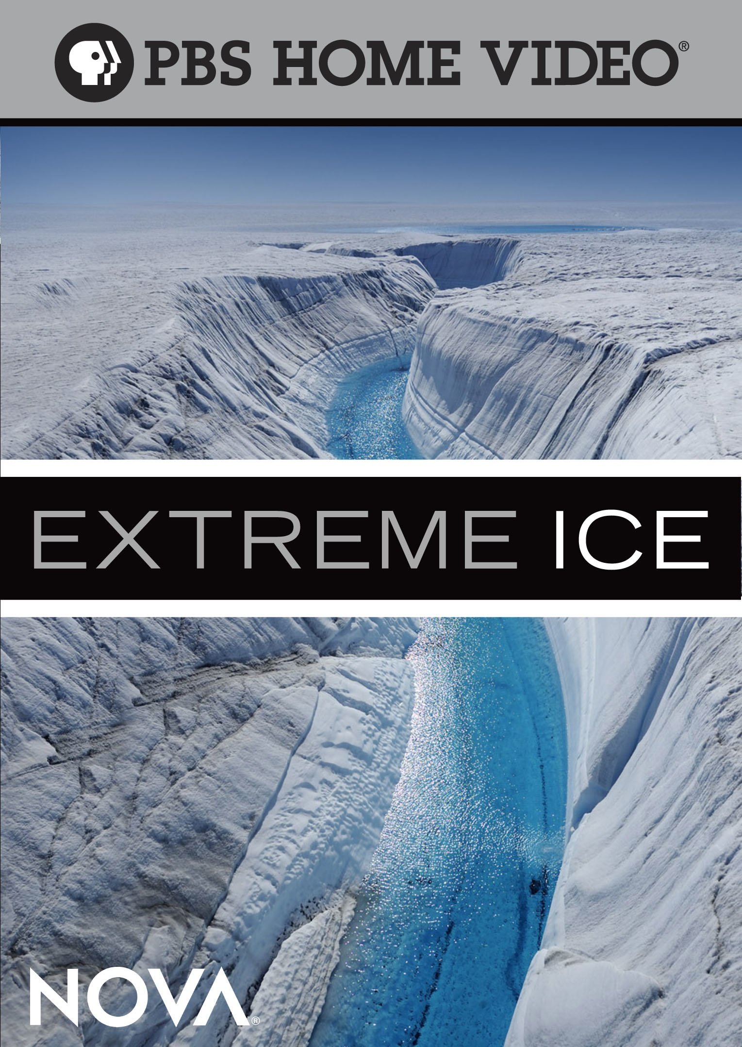 Extreme Ice Cooling Gel - Fast Pain Relief for Muscle & Joint Pain - Perfect for Athletes, Gym Workouts & Post-Surgery Recovery