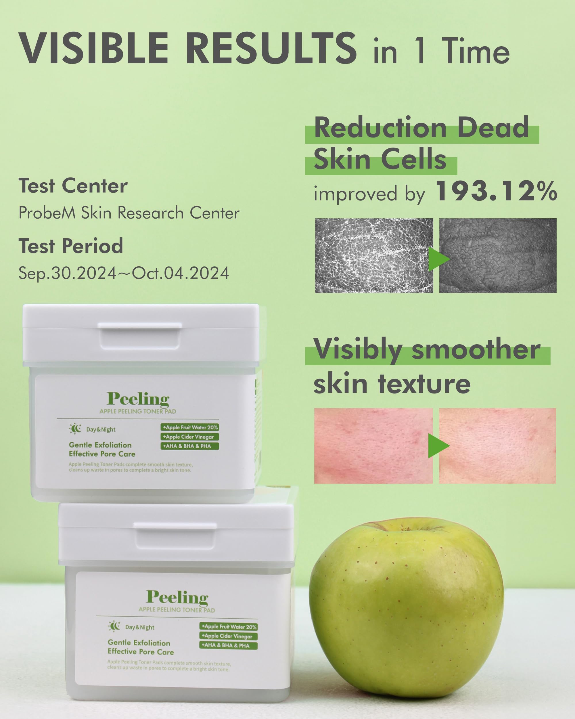 DERMAL Apple Peeling Toner Pads & Madecassoside Blemish Control Pads Bundle - Exfoliating & Acne Treatment for Clear Skin - Perfect for Daily Skincare Routine & Travel