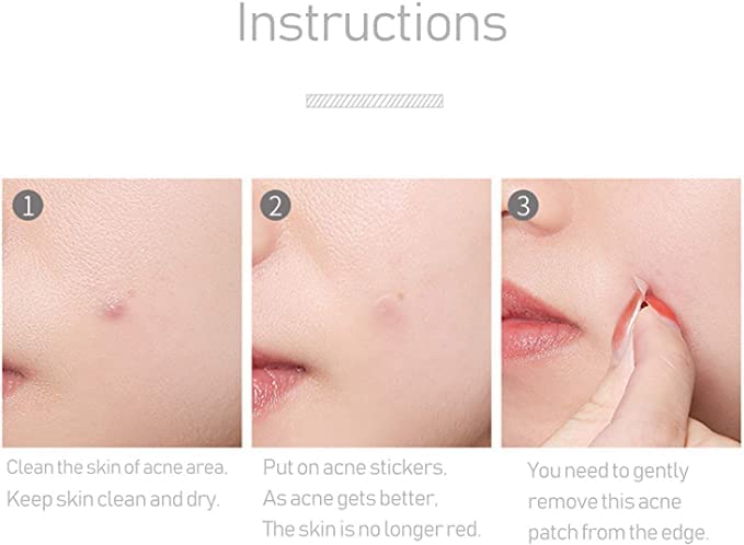108 Hydrocolloid Skin Tag Removal Patches - Top-Grade Pimple & Skin Tag Treatment - Covers & Conceals Blemishes - Perfect for Face, Body & Sensitive Skin Care