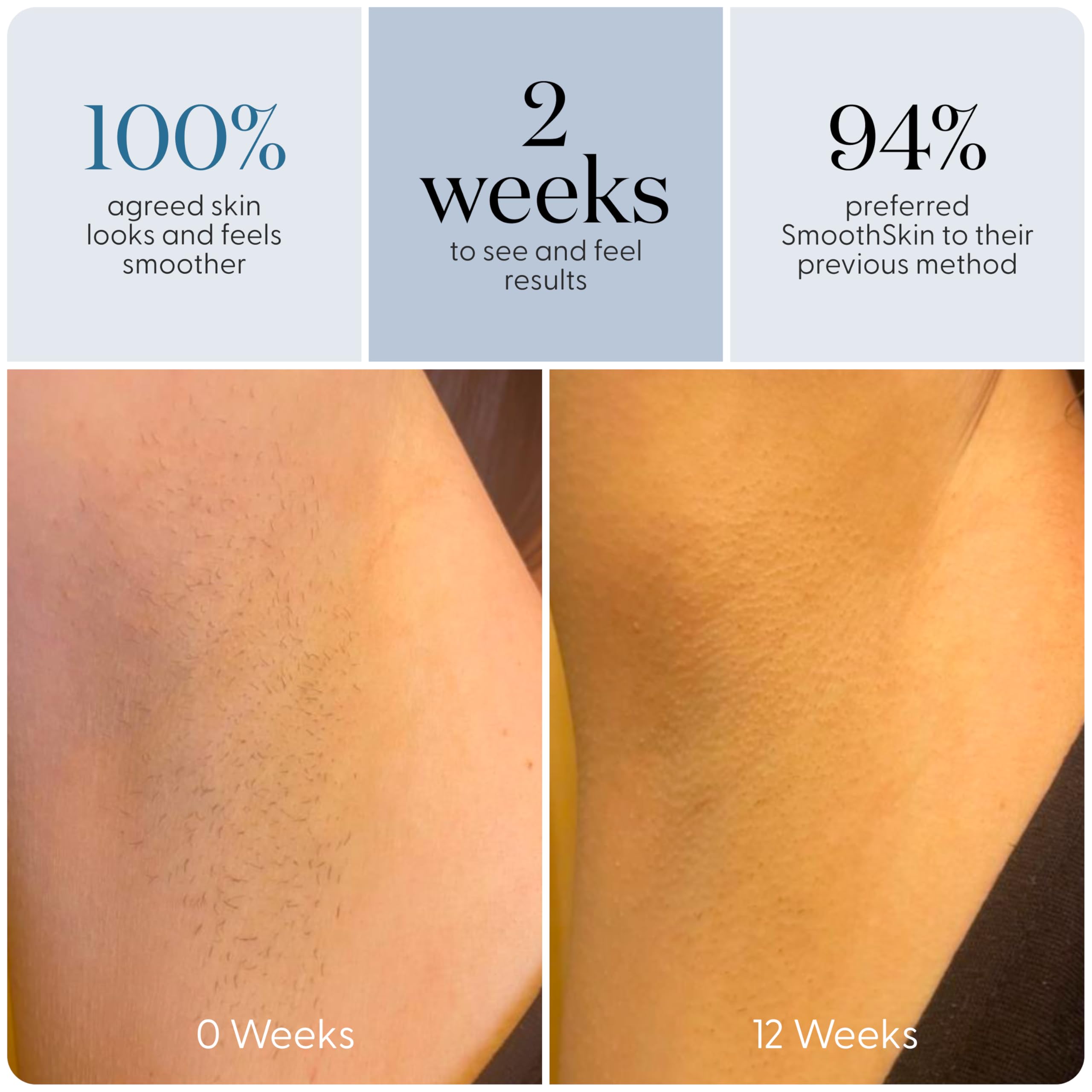 SmoothSkin Pure Adapt Limited Edition Slate Gray IPL Laser Hair Removal Device for Body & Face - At-Home Hair Removal Alternative to Salon, Epilator & Bikini Shaver - Perfect for Smooth Legs, Underarms & Bikini Line