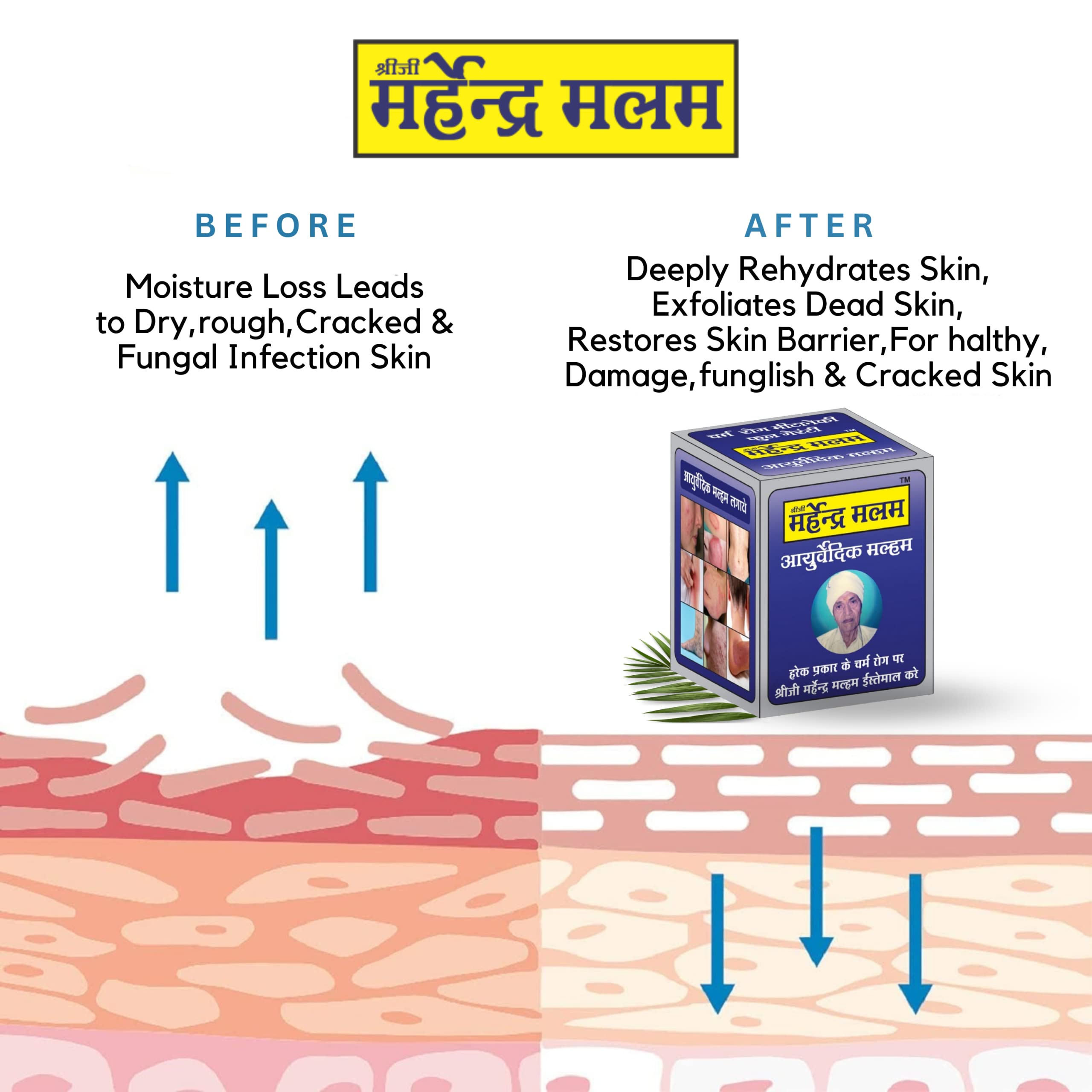 KESHBINDU Shreeji Marhendera Ayurvedic Foot Nourishing & Allergy Relief Cream - 25gm (Pack of 2) | Natural Herbal Remedy for Dry, Cracked Feet & Skin Irritation | Perfect for Daily Foot Care & Comfort