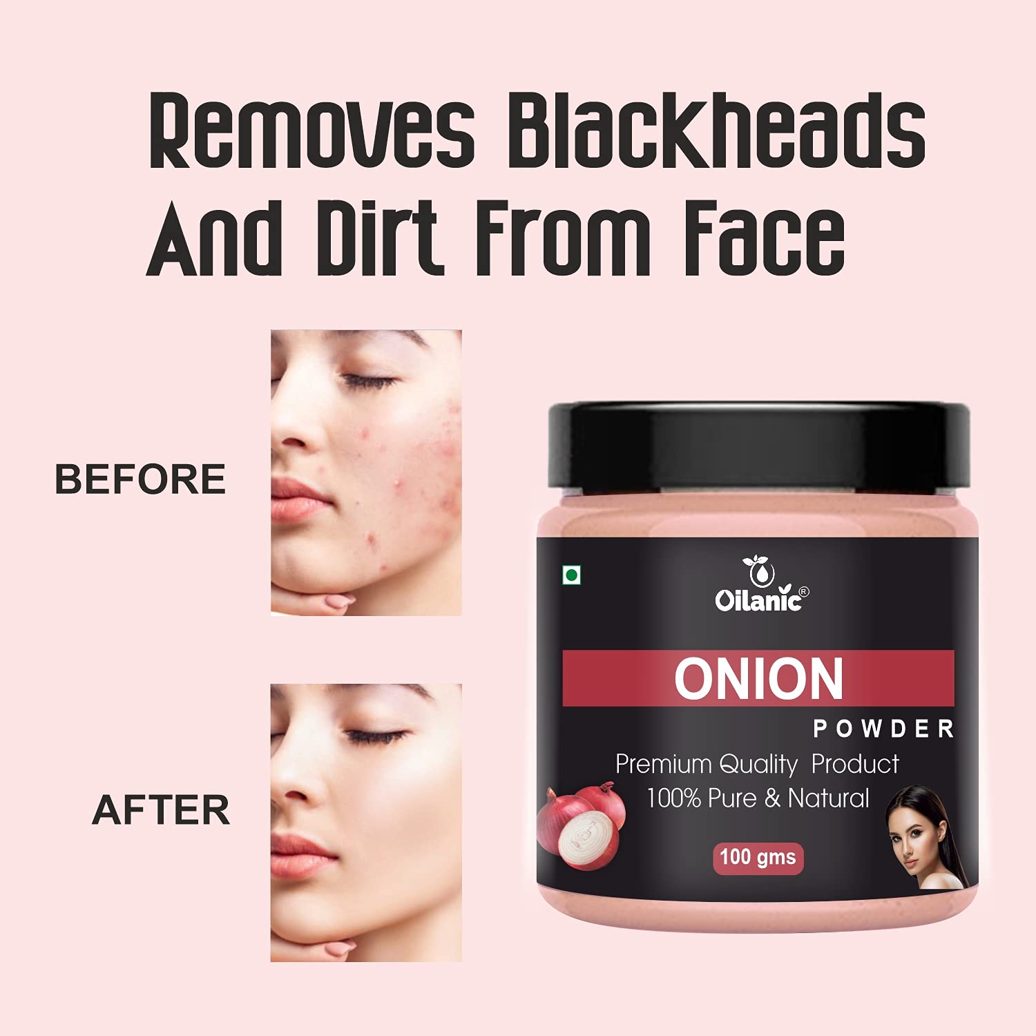 Oilanic 100% Pure Natural Onion Powder for Hair Growth & Skin Care - 2 Pack (200g Each) | Organic Onion Extract for DIY Hair Masks, Scalp Treatments & Natural Skincare Recipes