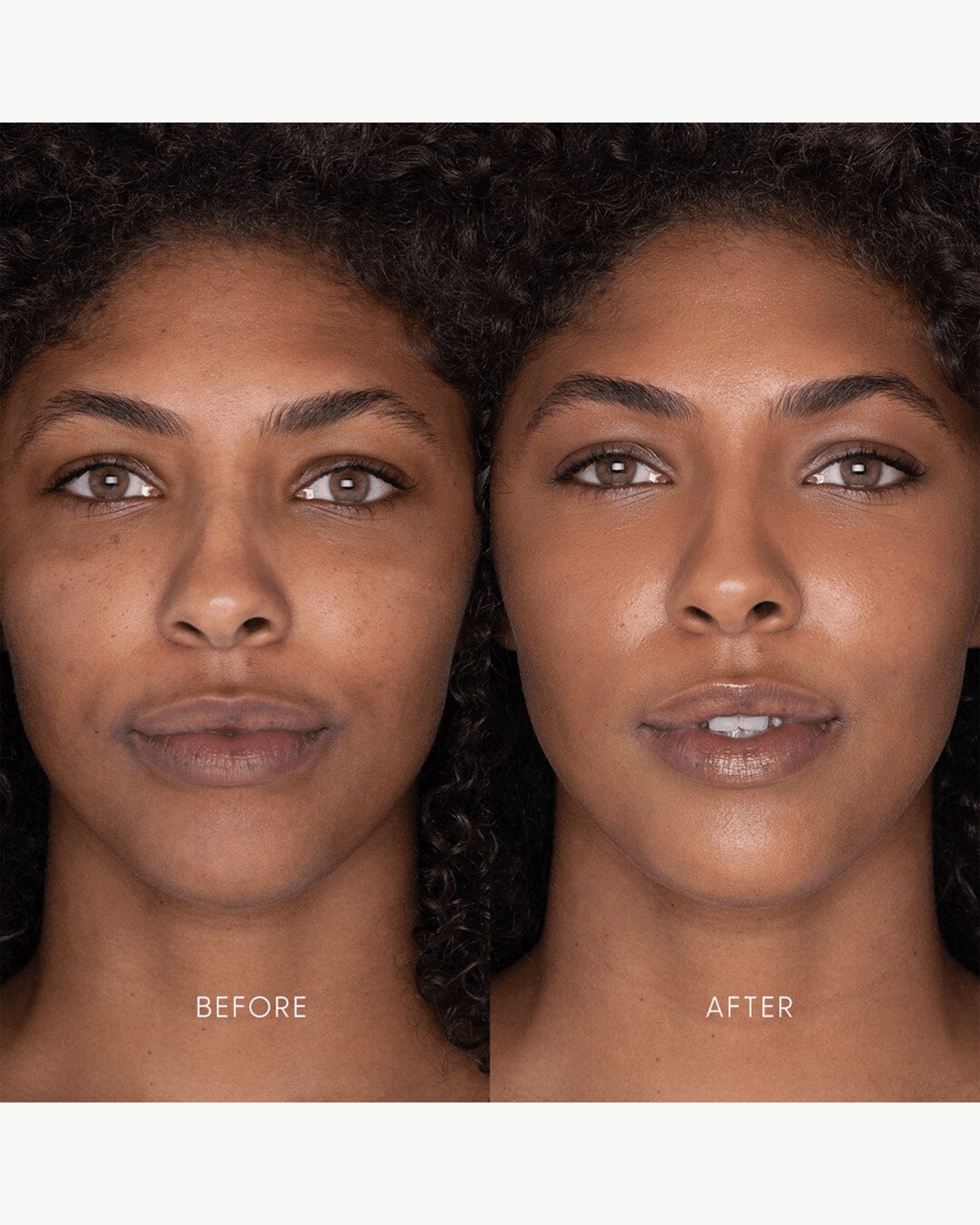 Best Skin Days Treatment Concealer - Full Coverage, Hydrating & Long-Lasting | Perfect for Dark Circles, Blemishes & Everyday Makeup Routine