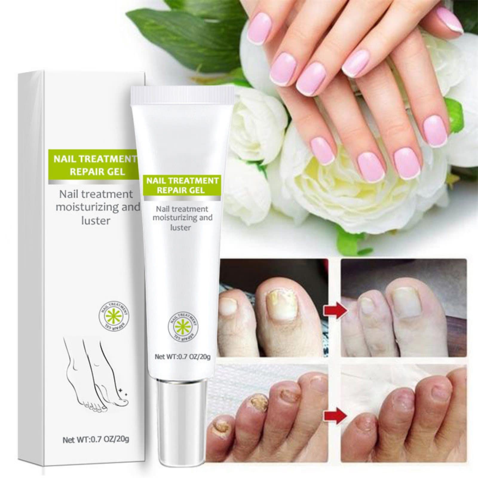 2PCS Nail Repair Gel for Fungal & Damaged Nails - Toenail Treatment & Care - Fast Results in 7 Days - Strengthens & Restores Nails - Perfect for Pedicures, Manicures & At-Home Nail Care
