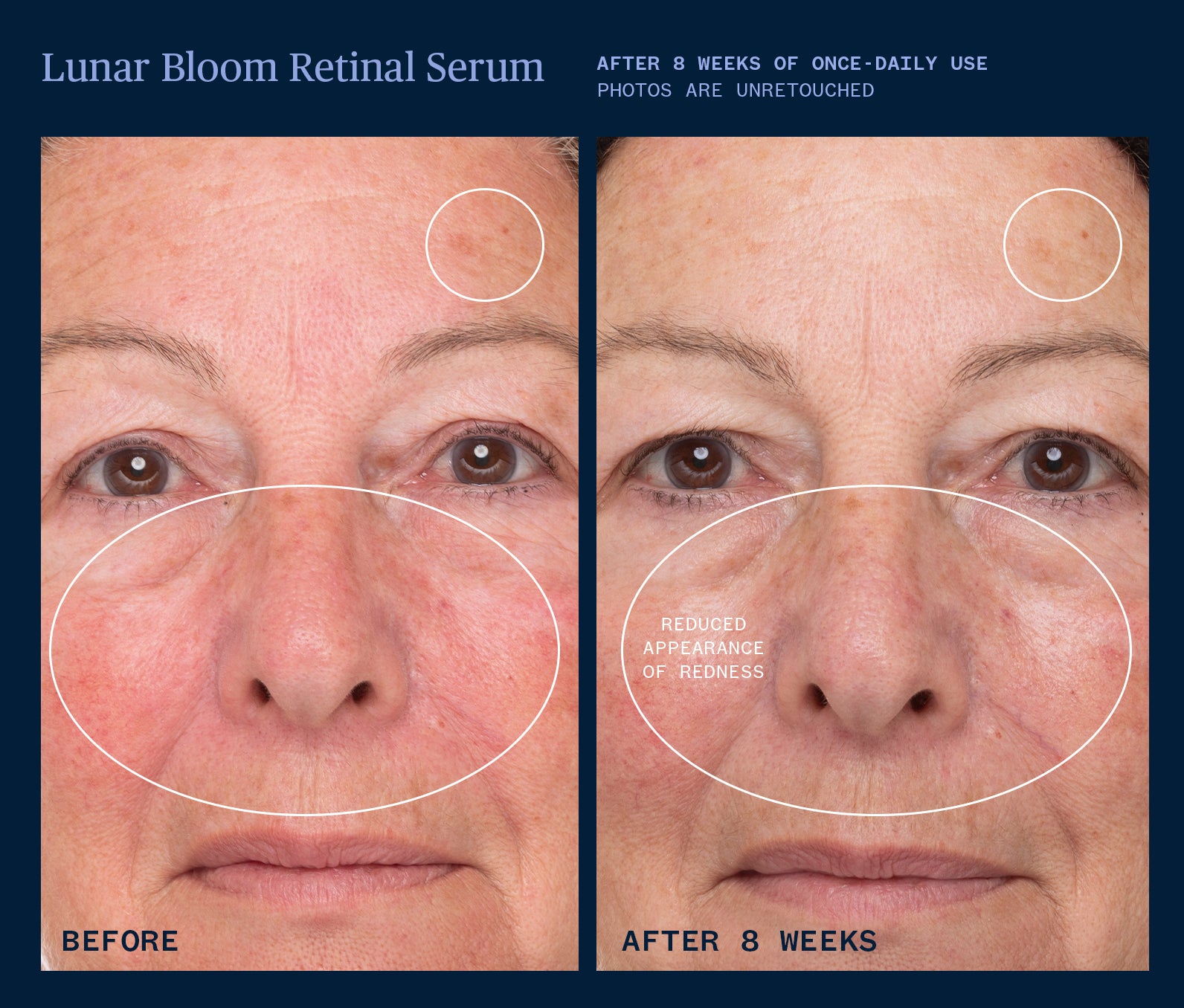 Lunar Bloom Retinal Serum for Wrinkles & Anti-Aging | Dark Spot Corrector & Night Repair Treatment | Perfect for Dry, Sensitive Skin & Evening Skincare Routine