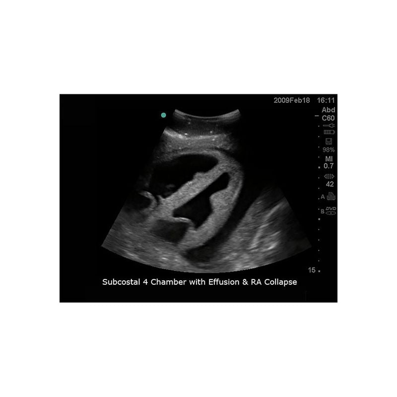 FAST Exam Ultrasound Training Model - Transthoracic & Transesophageal Echo Simulator for Cardiac Sonography Practice (Ideal for Medical Students, Ultrasound Tech Training & Clinical Skills Development)