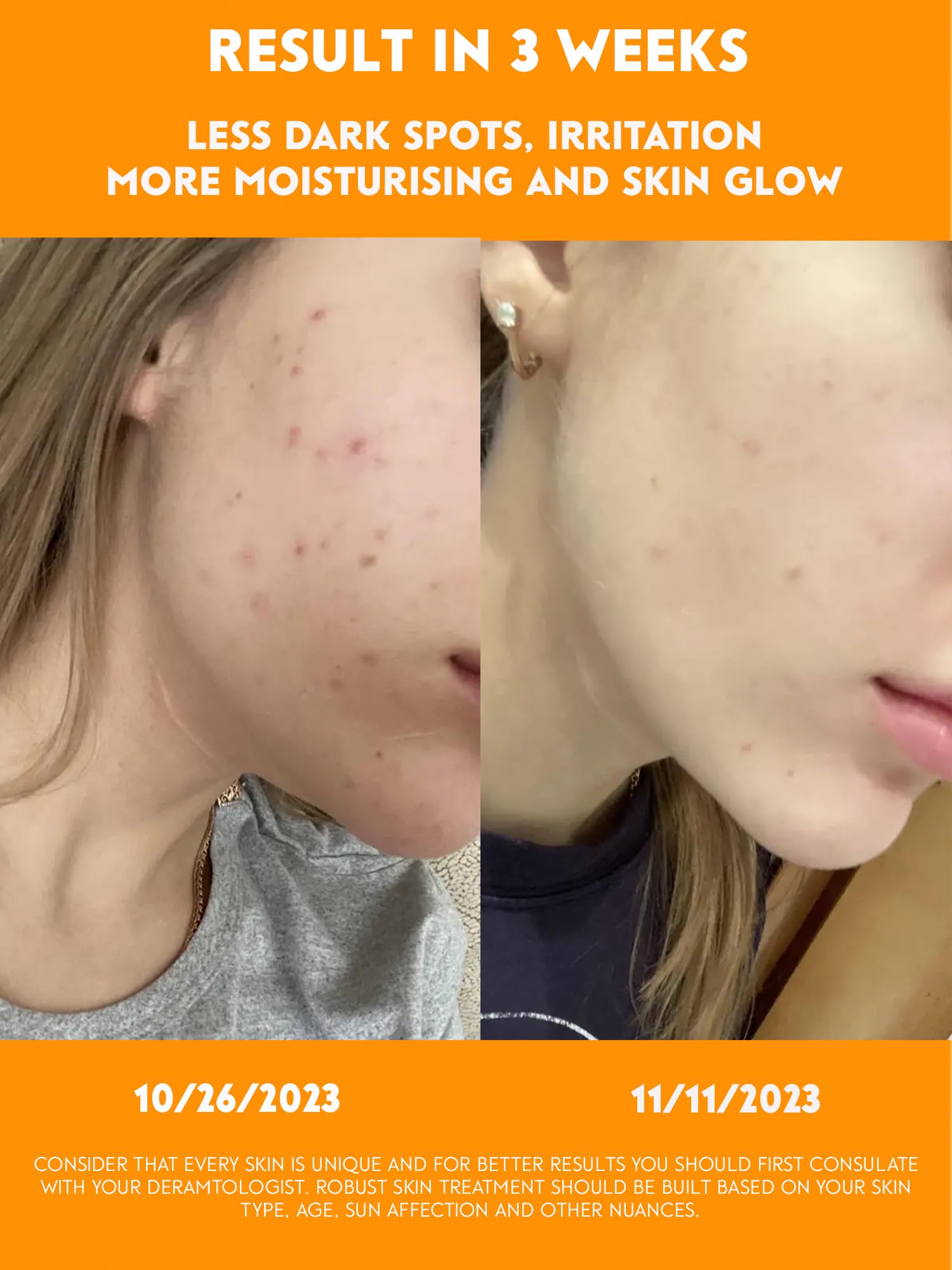 Brightening Papaya Face Milk Serum with Vitamin C & Niacinamide - 1 Fl Oz / 30ml - Hydrating & Glow-Boosting for Dull Skin, Dark Spots & Uneven Tone - Perfect for Morning & Night Skincare Routine