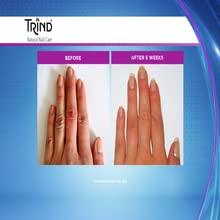 Trind Keratin Restorer - Nail Strengthener for Damaged & Brittle Nails, 9ml Treatment for Stronger, Healthier Nails | At-Home Nail Care Solution for Weak, Peeling Nails