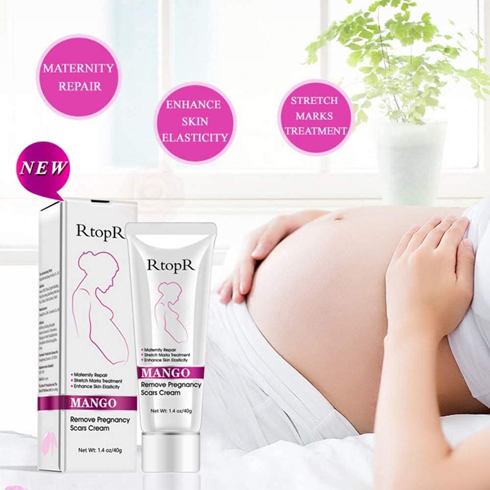 RtopR Mango Stretch Marks & Scar Removal Cream for Pregnancy - Best Body Moisturizer for Smooth Skin - 80g - Perfect for Postpartum Care & Skin Repair