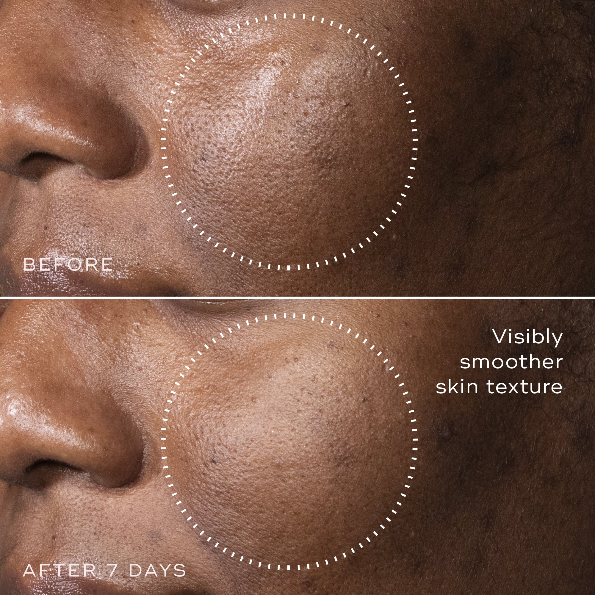 C Tetra™ Advanced Gel Serum - Vitamin C Brightening & Hydrating Face Serum for Glowing Skin | Day & Night Use for All Skin Types