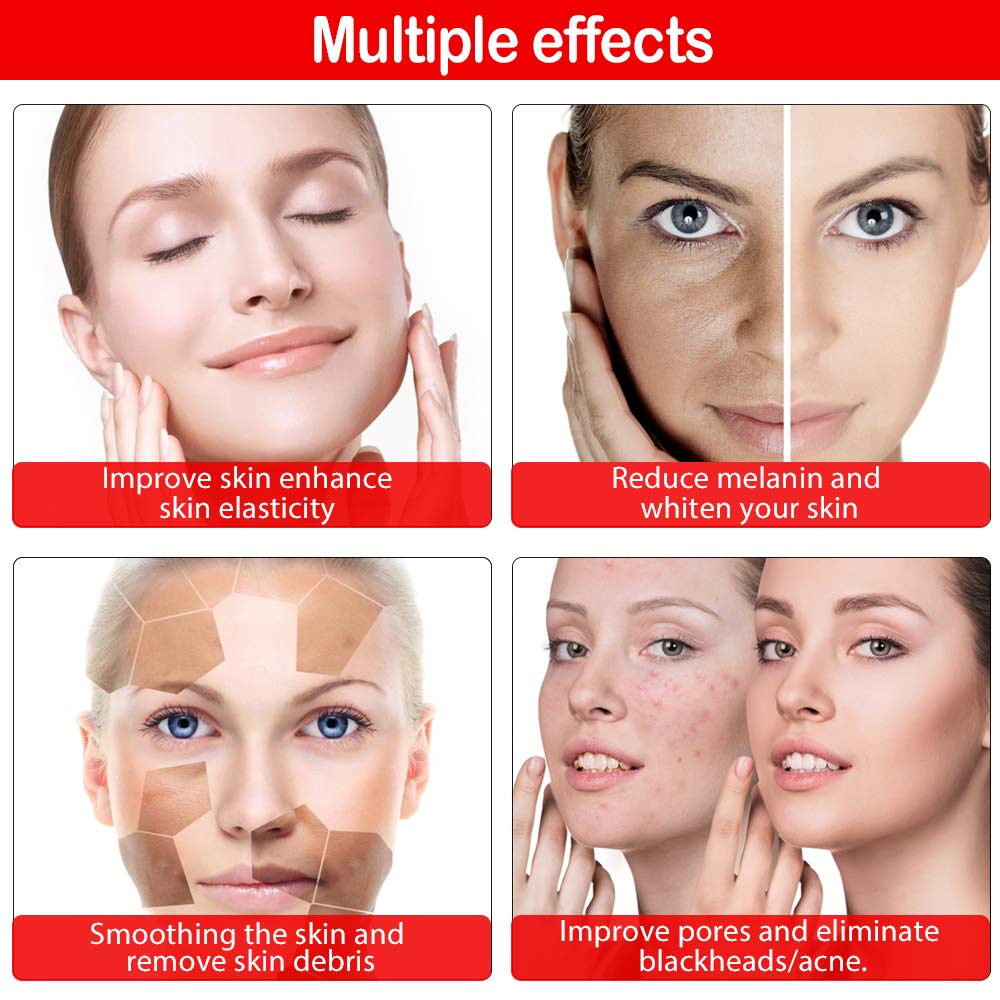 Professional Diamond Microdermabrasion Machine for Face - 65-68cmHg Suction Power, At-Home Facial Care & Skin Exfoliation Tool - Perfect for Anti-Aging, Blackhead Removal & Glowing Skin