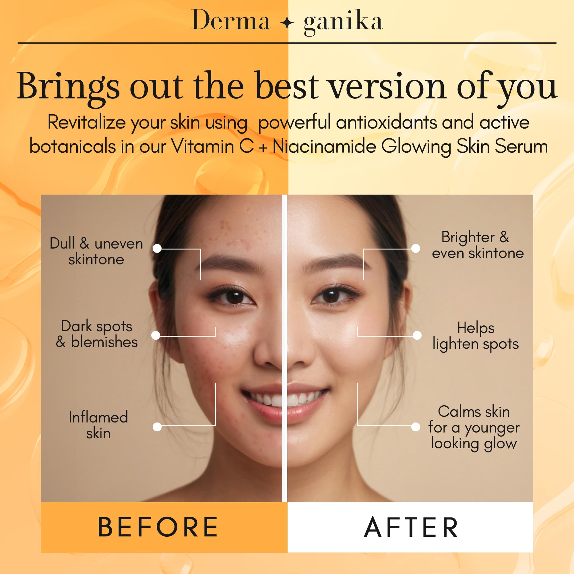Derma Ganika Vitamin C & Niacinamide Serum for Face - USA Made Brightening & Anti-Aging Serum | Boosts Collagen, Evens Skin Tone, Reduces Dark Spots & Hyperpigmentation | Perfect for Daily Skincare Routine & Nighttime Use