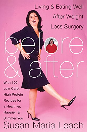 Best Healthy Living & Eating Guide for Weight Loss Surgery Patients - Before & After Tips for Recovery & Wellness | Post-Bariatric Diet Plans & Lifestyle