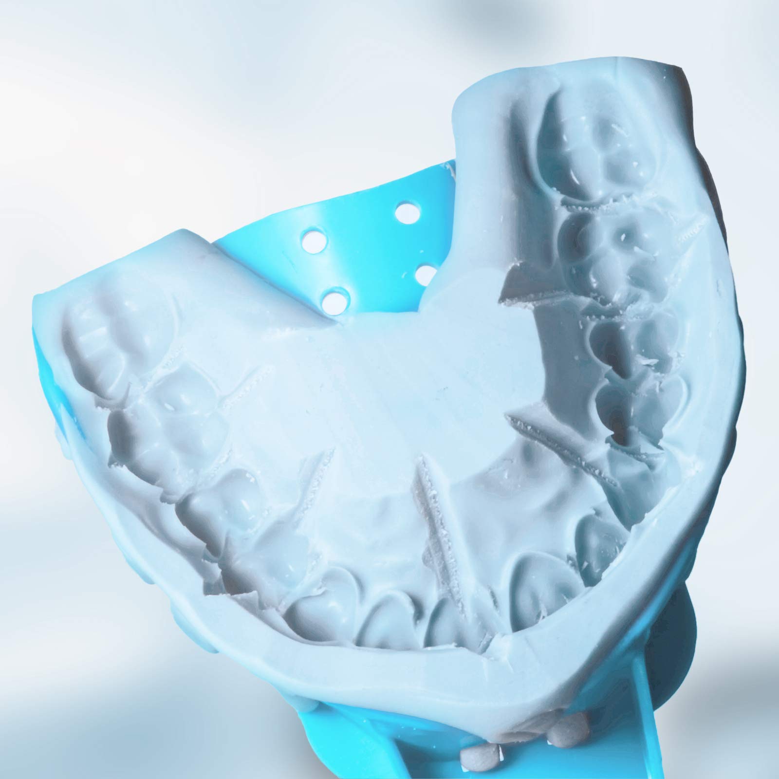 JMU Disposable Dental Impression Trays - Perforated Quadrant Trays (UR/LL, 8 Size) - Pack of 12 for Accurate Teeth Molds | Ideal for Dentists, Orthodontists & Dental Labs
