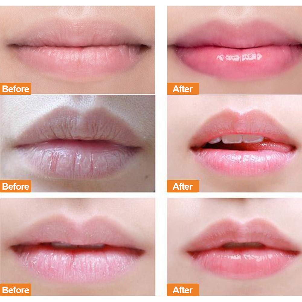 Collagen Peptide Lip Sleep Mask & Peach Lip Scrub - Overnight Moisturizing Treatment for Dry, Chapped, Peeling & Cracked Lips | Hydrating Lip Balm for Deep Repair | Perfect for Nighttime Lip Care & Winter Lip Protection (Peach Scent)