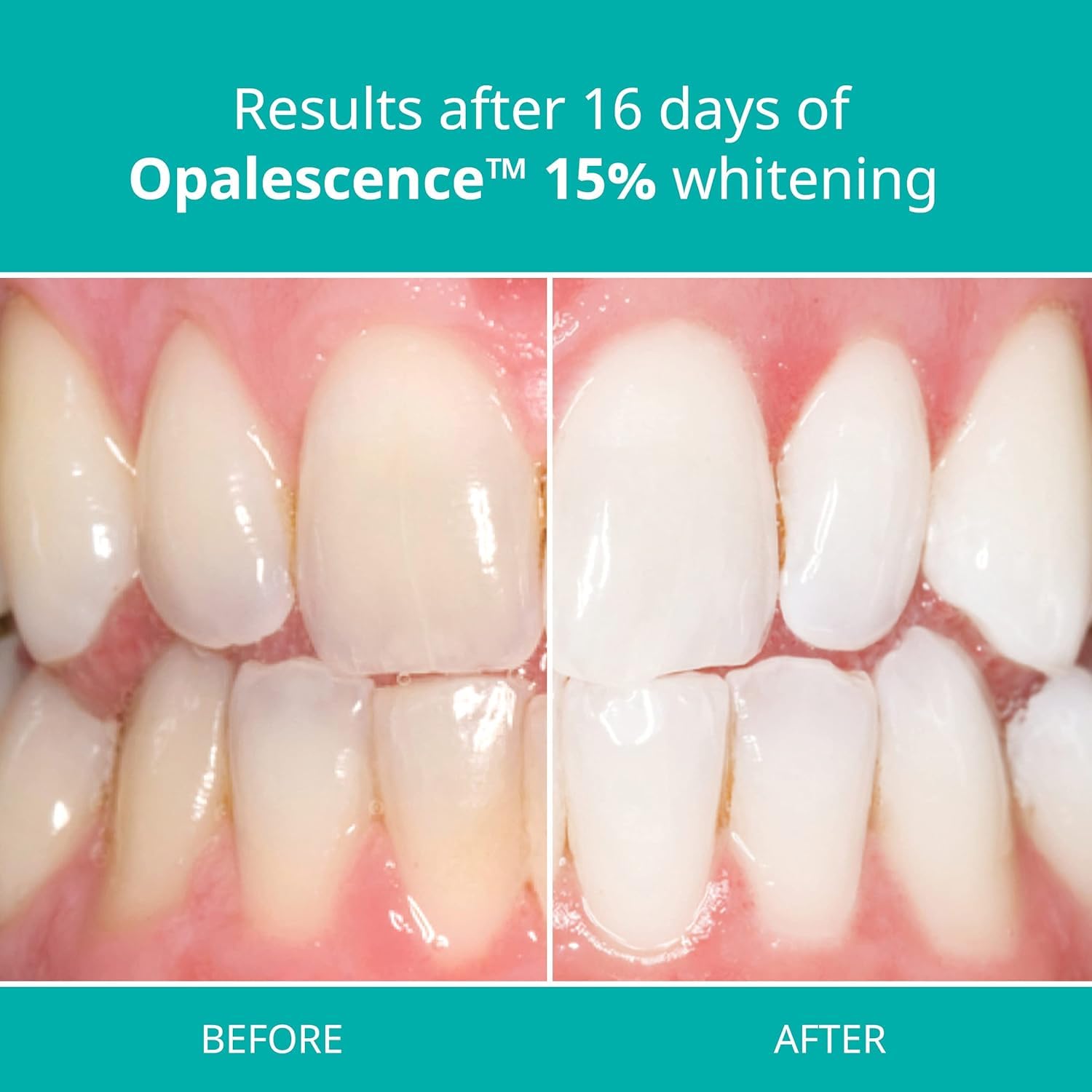 Opalescence 15% Teeth Whitening Gel Syringes Refill Kit - Low Sensitivity (4 Packs / 8 Syringes) - Carbamide Peroxide Whitening Gel - Cool Mint Flavor - Made in USA by Ultradent - Professional Dental Whitening for Home Use - Brighten Smile for Weddings, Photos & Special Events