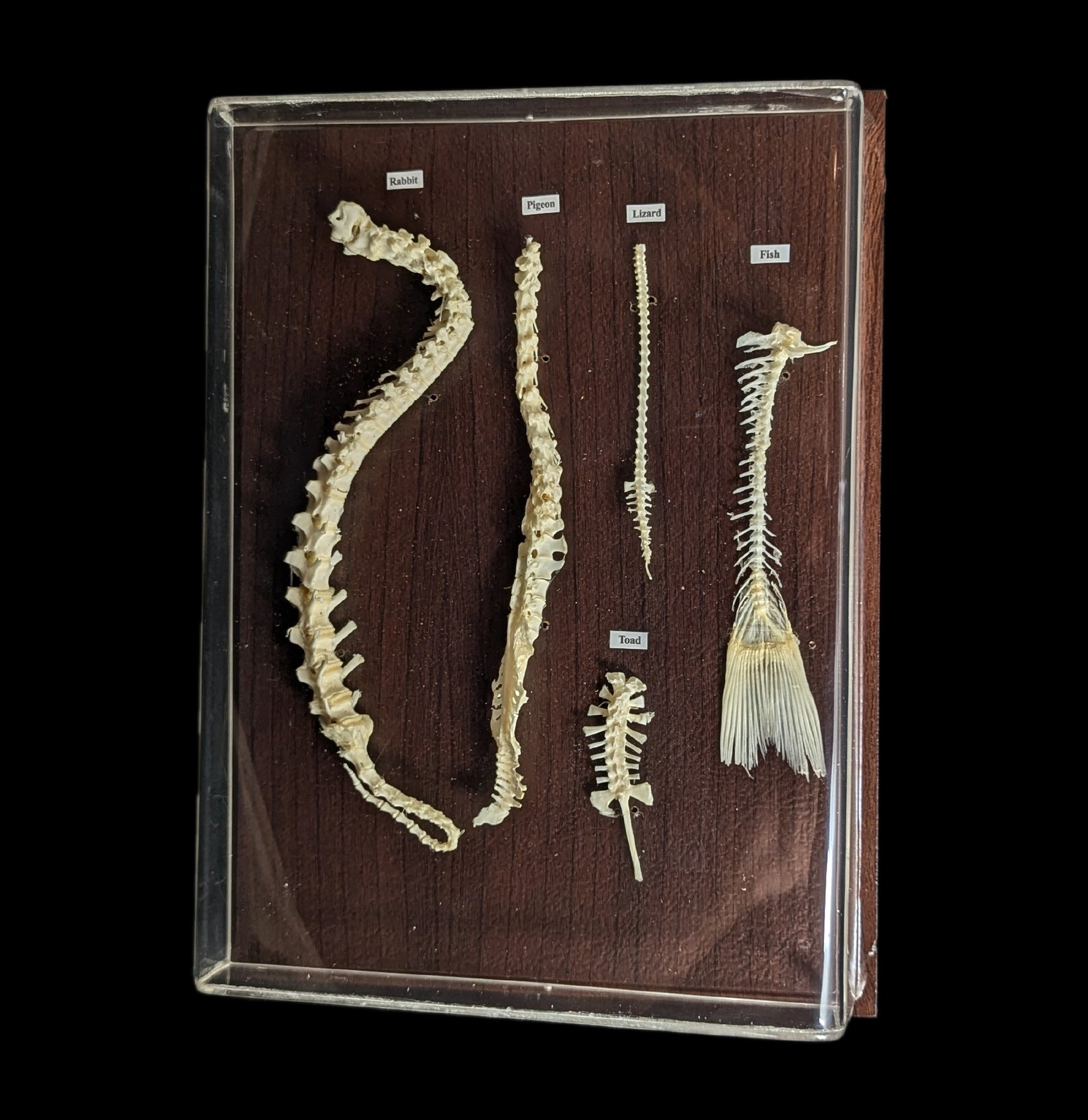 Spinal Column Comparisons - Anatomy Models for Medical Students & Professionals | Perfect for Study, Teaching & Clinical Reference