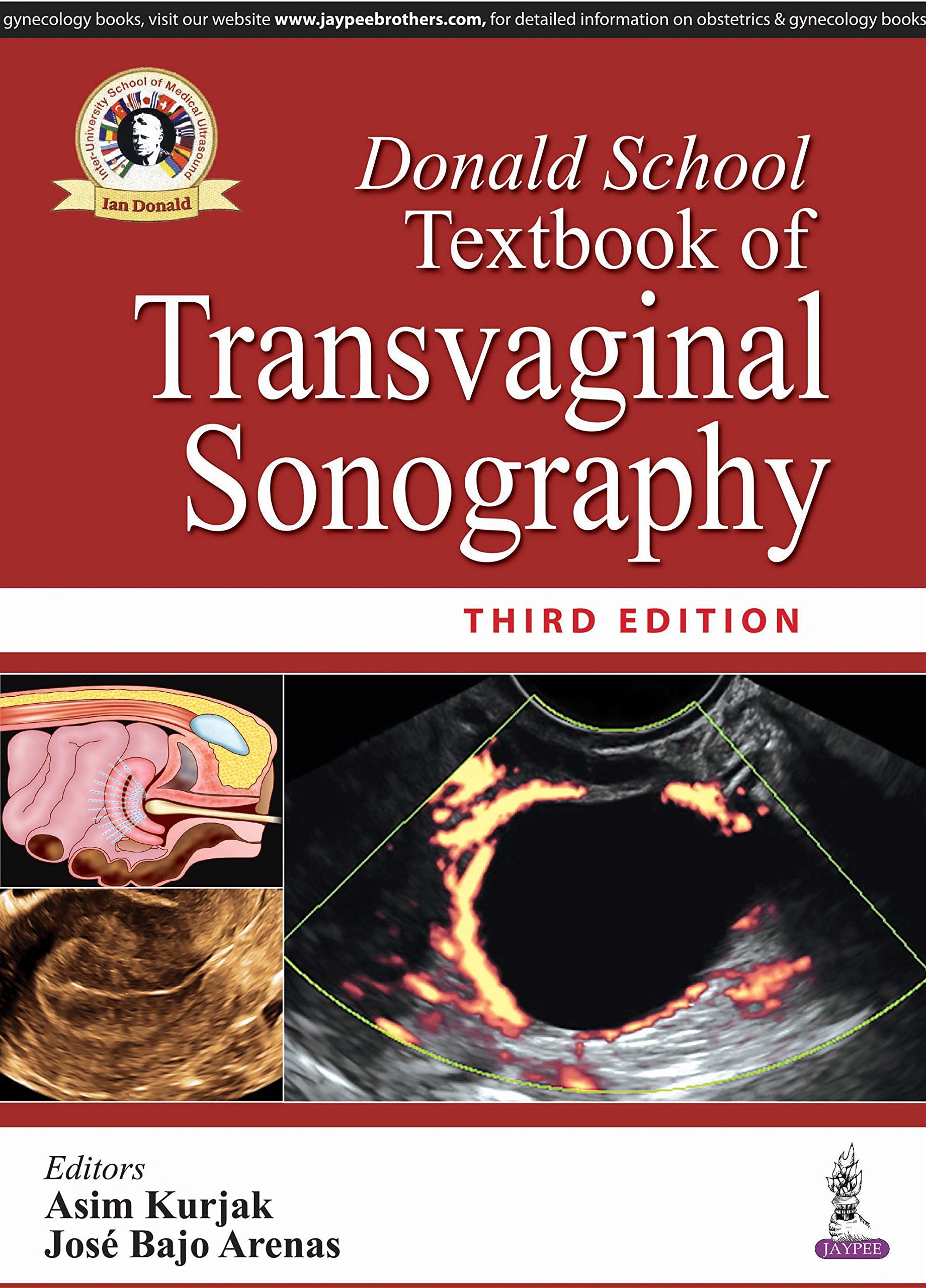 Donald School Textbook of Transvaginal Sonography - Comprehensive Guide for Medical Professionals & Students | Ultrasound Imaging for Gynecology & Obstetrics