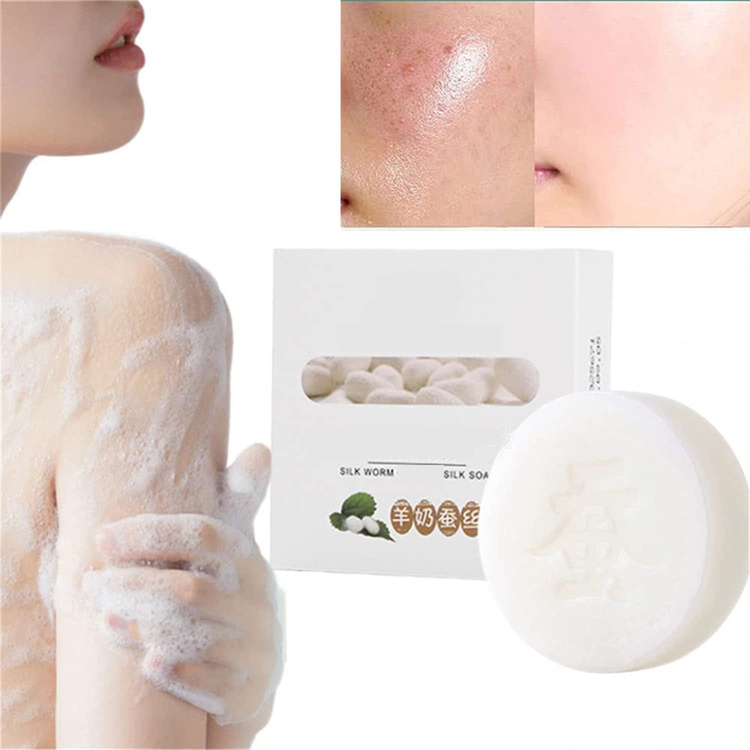 Skinferm Collagen Milk Whitening & Acne Treatment Soap - 3 Pack for Face and Body Care | Anti-Blemish, Anti-Cellulite & Skin Repair with Silk Protein | Perfect for Daily Cleansing, Back Acne Treatment & Smooth Soft Skin