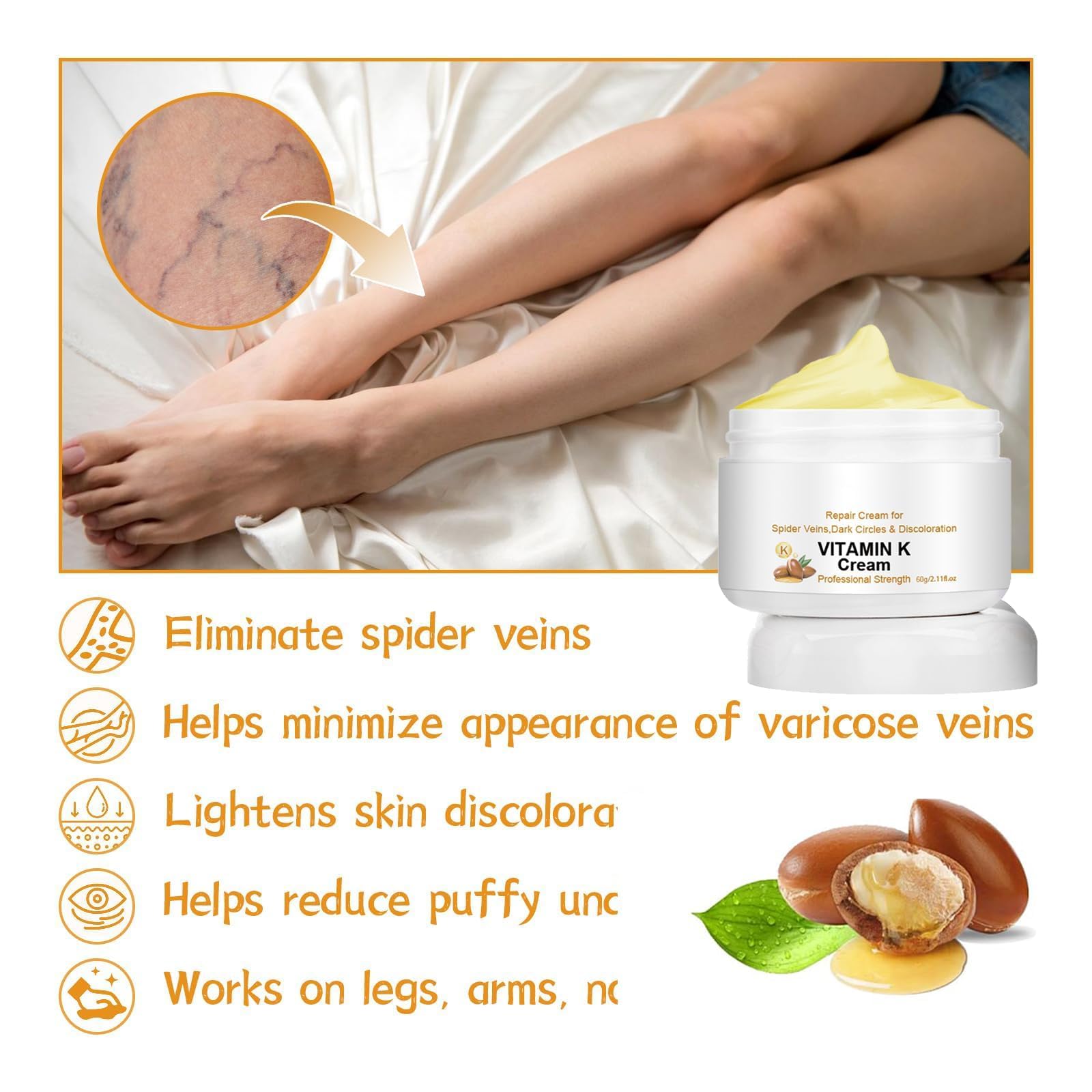 Best Varicose Veins Repair Cream with Vitamin K - Leg Vein Treatment for Men & Women - Soothing Relief for Spider Veins & Swollen Legs - Perfect for Daily Use at Home, Work or Travel