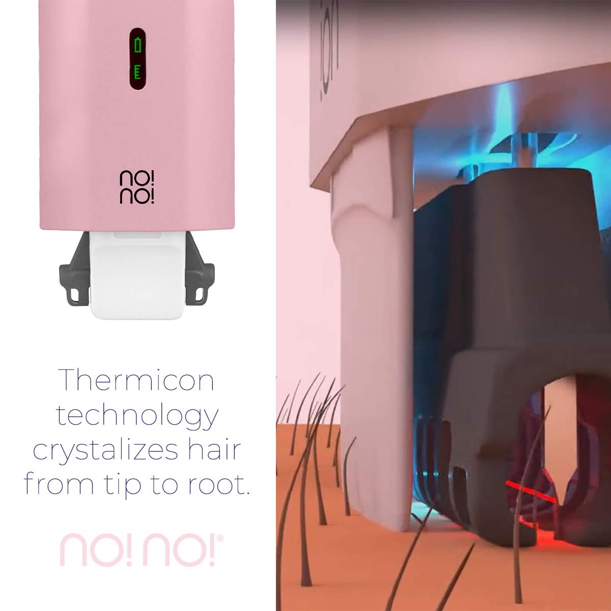 NO!NO! Micro Hair Removal Device for Women & Men - Painless & Rechargeable Hair Remover for Face & Body, Suitable for All Skin Tones, Wireless & Portable IPL Device - Perfect for Travel, Home & Salon Use - Lilac