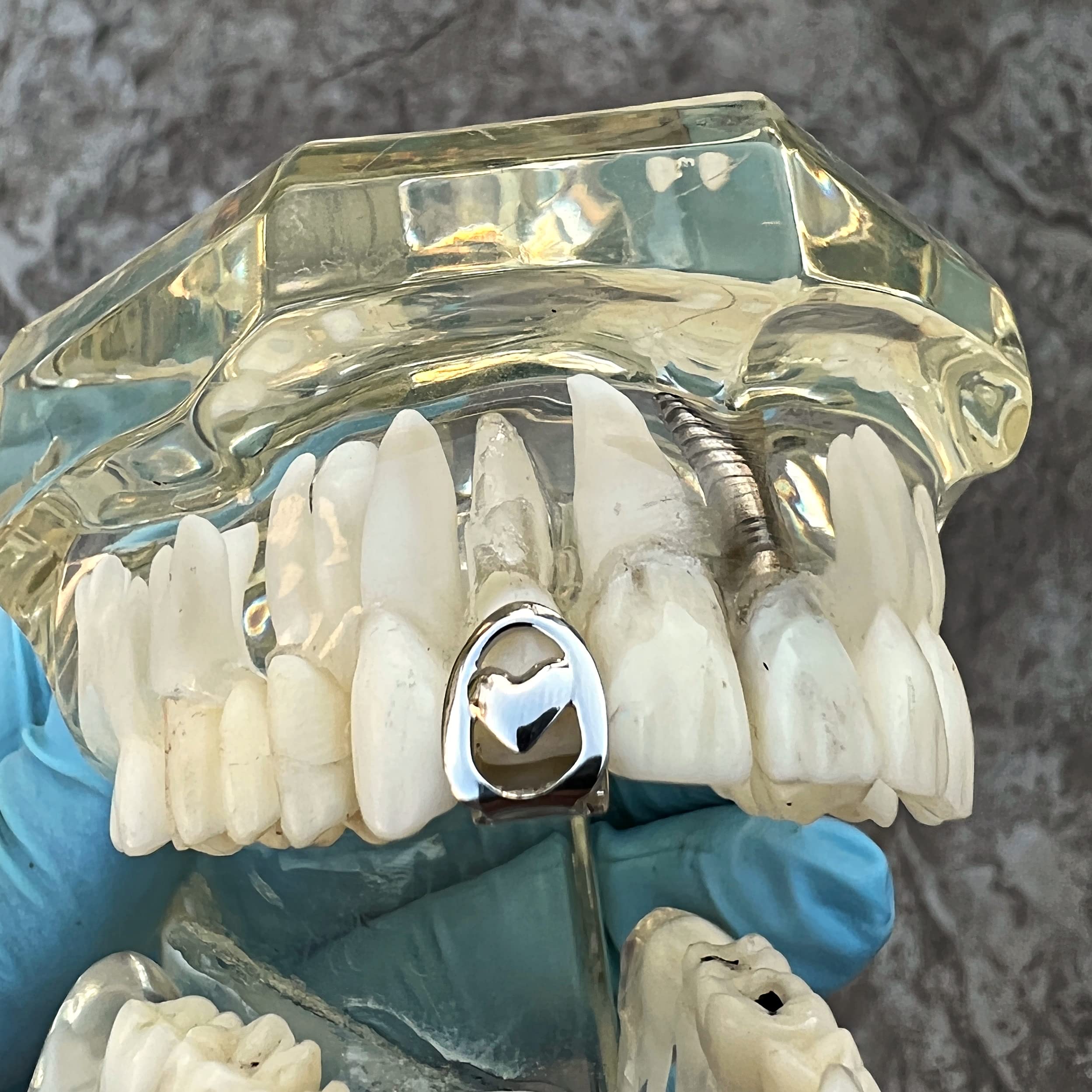Silver Tone Open Face Heart Grillz - Single Cap Top Upper Canine Tooth Grill for Hip Hop Style with Teeth Mold | Perfect for Rappers, Performers & Jewelry Enthusiasts