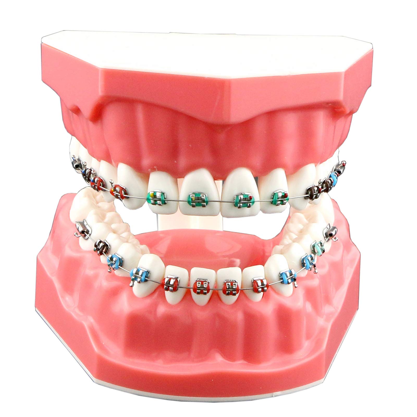 Orthodontic Dental Model with Metal Brackets, Archwires, Tubes & Ligature Ties - Standard Size Teeth Treatment Model for Dental Students & Professionals | Perfect for Teaching, Studying & Clinical Practice