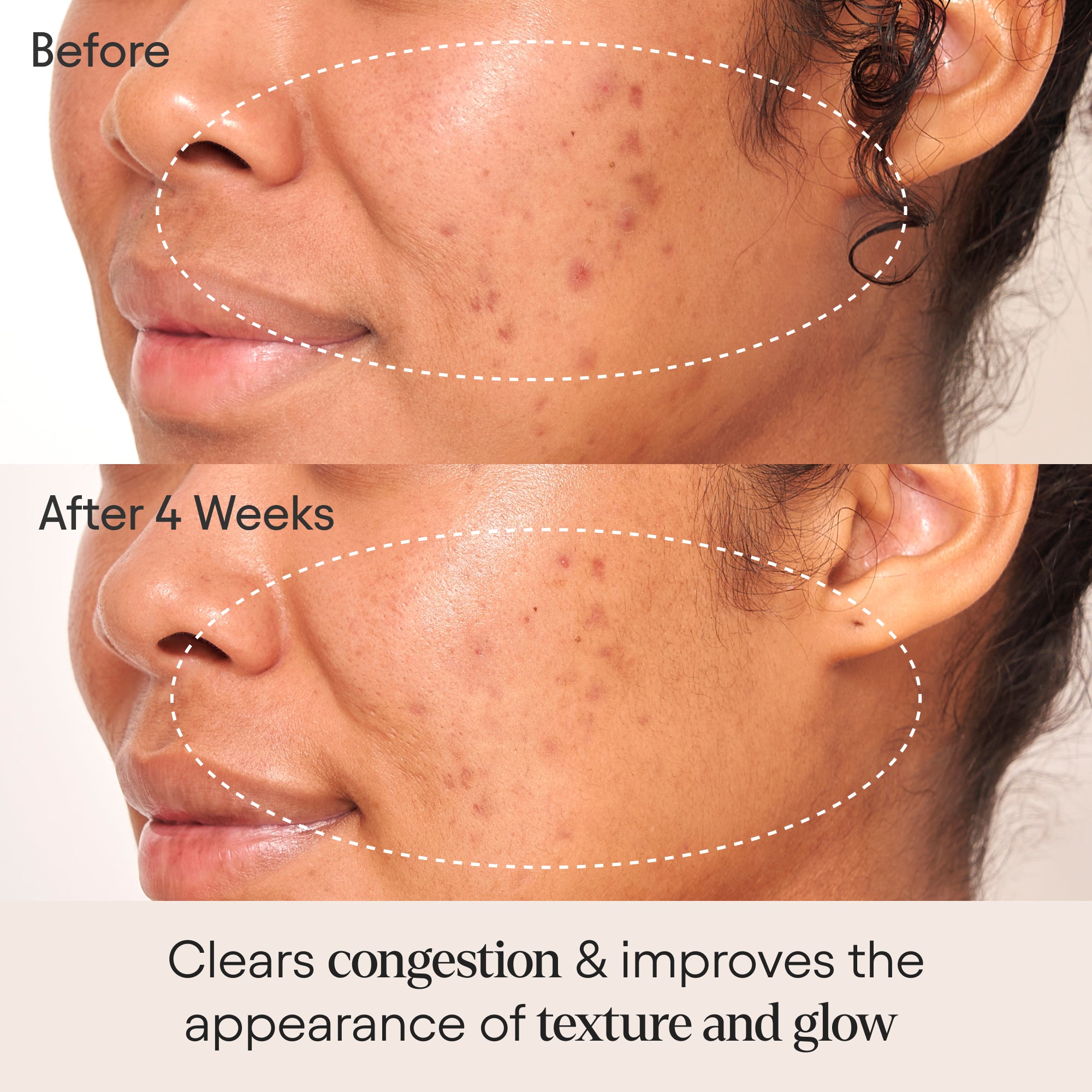 Clarifying Facial Oil with Retinol & Pink Algae - Anti-Aging, Brightening & Hydrating Skincare for Glowing Skin - Perfect for Night Routine & Dry Skin Care