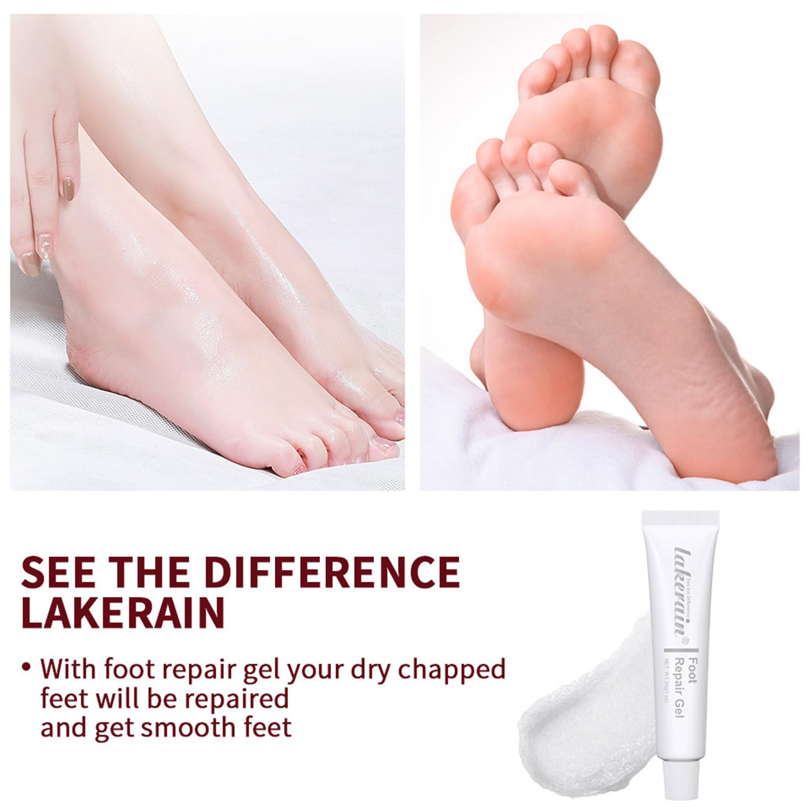 Miracle Foot Repair Cream for Dry Cracked Heels - Fast Healing Foot Gel Softens & Moisturizes Severely Chapped Skin, Exfoliates Dead Skin - Visible Results in 1 Day - Perfect for Pedicures, Winter Foot Care & Diabetic Foot Relief