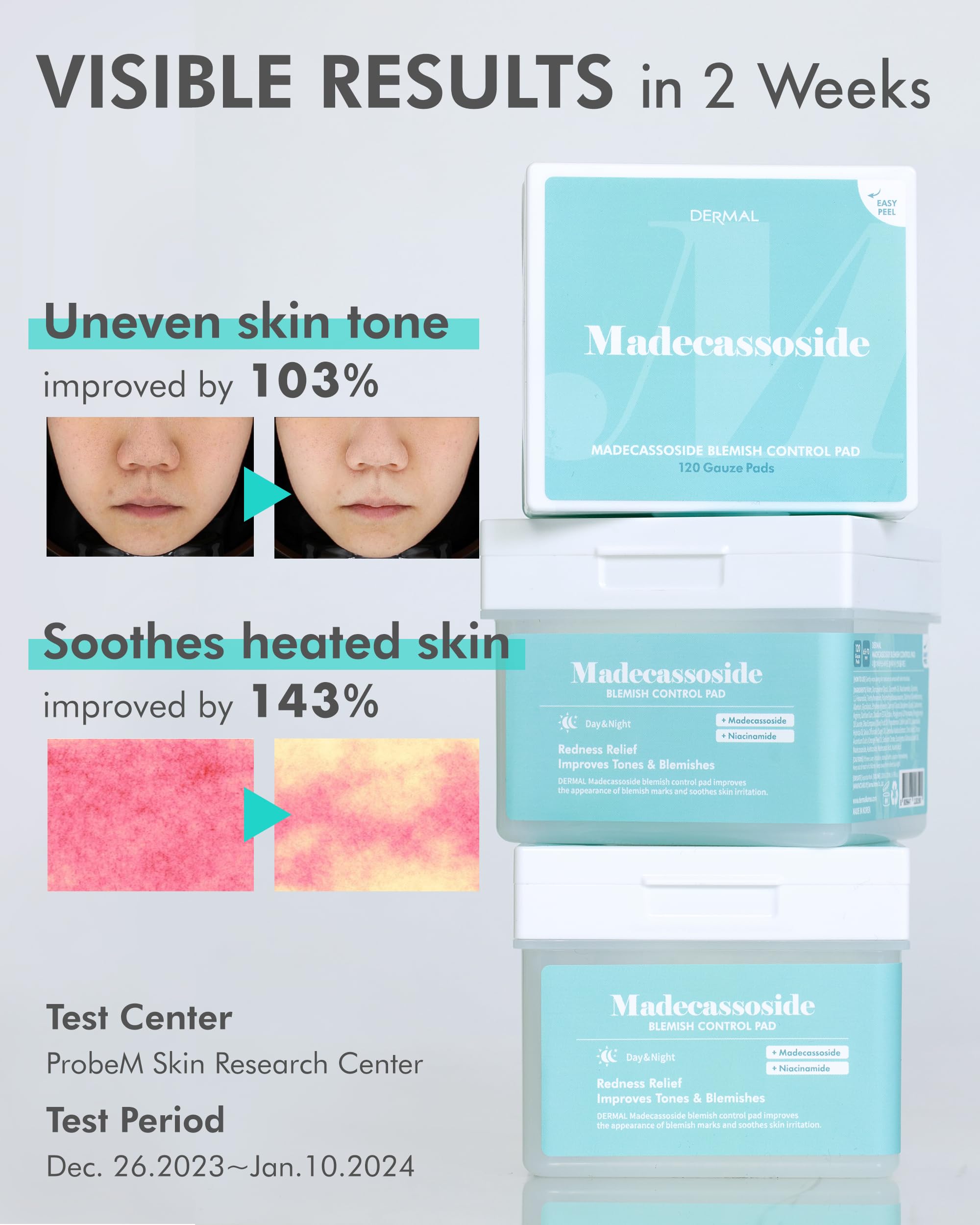 DERMAL Apple Peeling Toner Pads & Madecassoside Blemish Control Pads Bundle - Exfoliating & Acne Treatment for Clear Skin - Perfect for Daily Skincare Routine & Travel