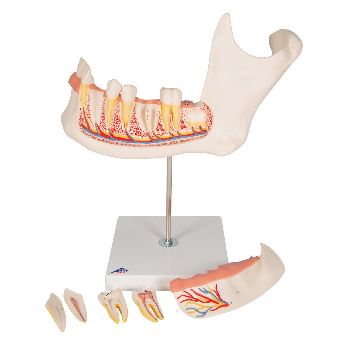 Half Lower Jaw Model - 3X Full Size, 6-Part Dental Anatomy Demonstration for Dental Students & Professionals | Perfect for Classroom Teaching & Medical Study