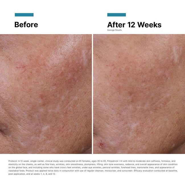 SkinCeuticals HA Intensifier Multi Glycan Serum - Hydrating Hyaluronic Acid Face Treatment for Plumper Skin | Anti-Aging & Moisturizing Skincare for Daily Use