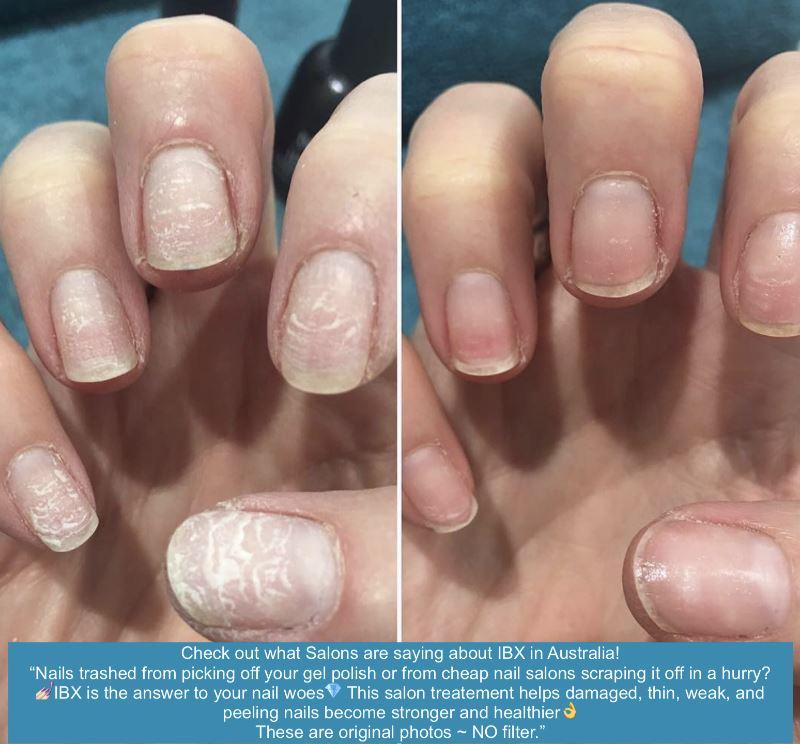 IBX Nail Strengthener & Repair Kit - TRIO PACK with FREE Cuticle Oil | Professional Nail Care Treatment for Weak, Damaged & Brittle Nails | At-Home & Salon Use