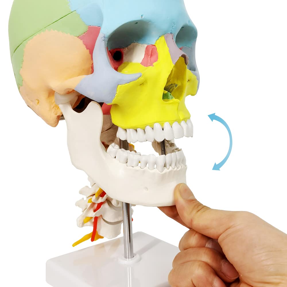 Human Anatomy Exploded Skull Model - Medical & Dental Teaching Tool for Students | Perfect for Classroom Demonstrations, Dental Clinics & Medical Education