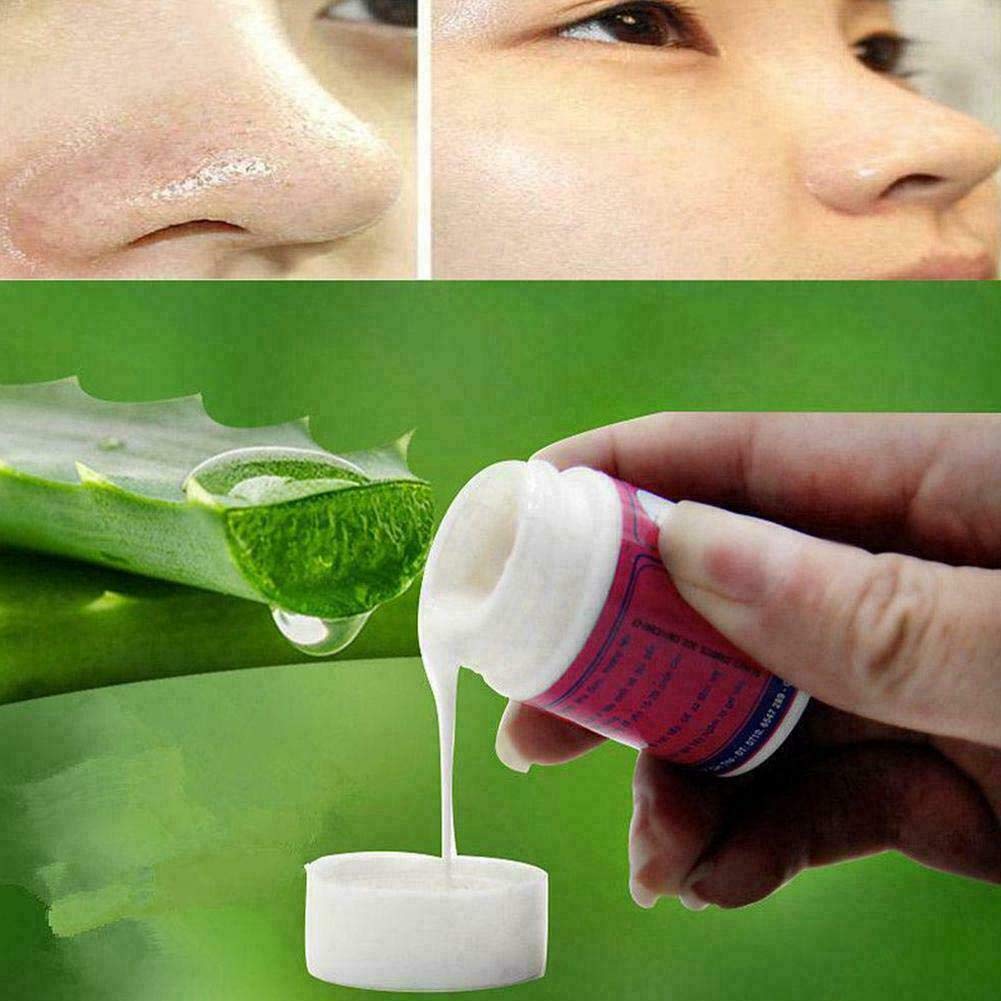 Pure Natural Aloe Vera Gel for Blackhead & Acne Treatment - Deep Cleansing Nasal Mask & Peeling Gel to Remove Blackheads, Shrink Pores (22g) | Perfect for Daily Skincare & Pore Refining Routine