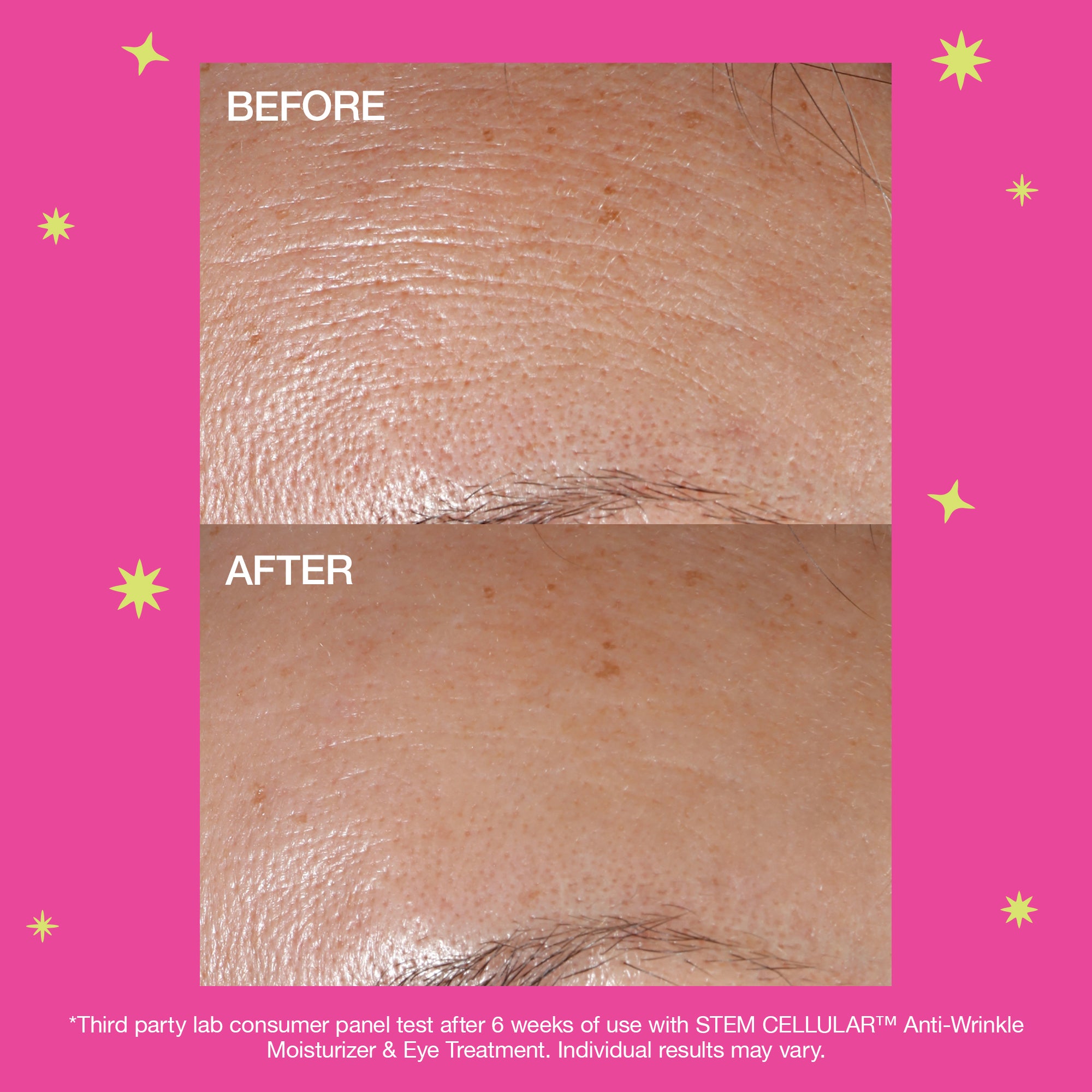 Anti-Wrinkle Cream Trio Set - Powerful 3-Step Wrinkle Reduction Treatment for Day & Night Use | Perfect for Daily Skincare Routine & Anti-Aging Care