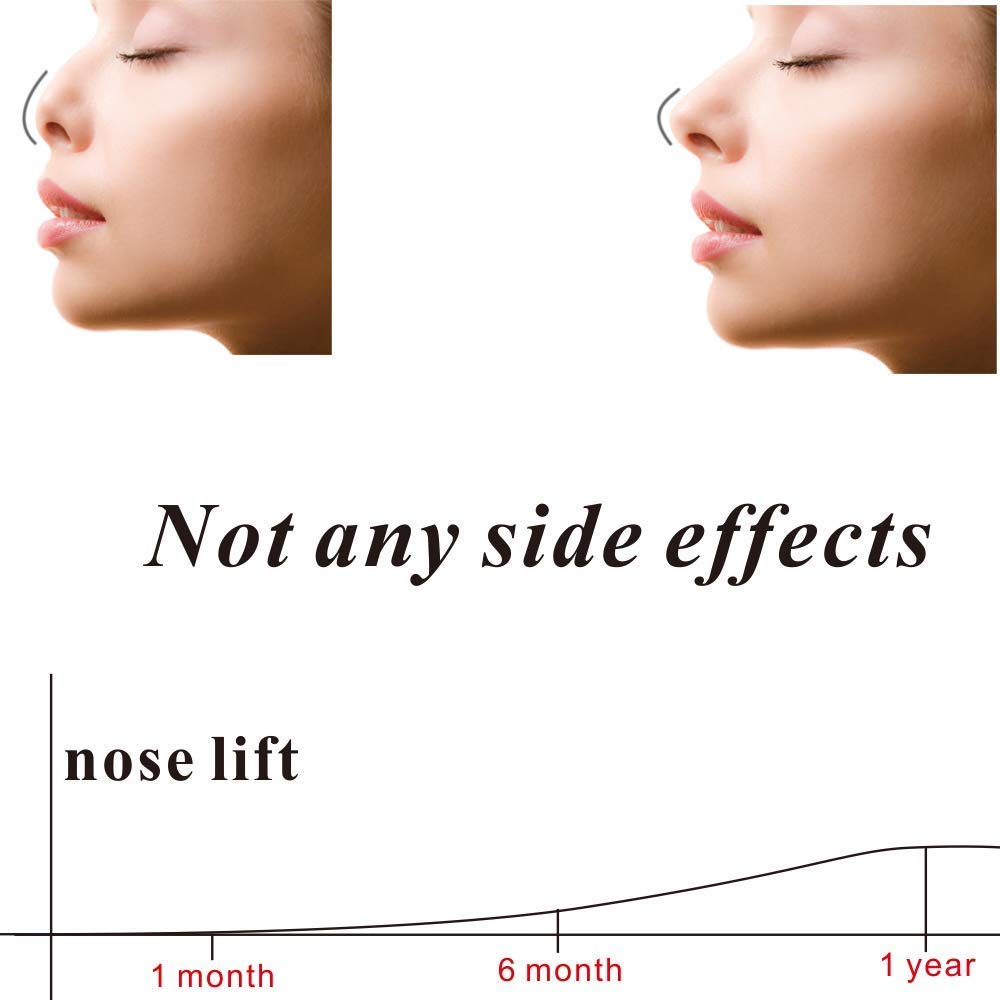 AlexVyan 2-Pack Nose Up Clip - Nose Shaping & Lifting Tool for Bridge Straightening, High Lift Clipper, Nose Correction Shaper - Beauty Enhancement Accessory for Everyday Makeup & Self-Care Routine