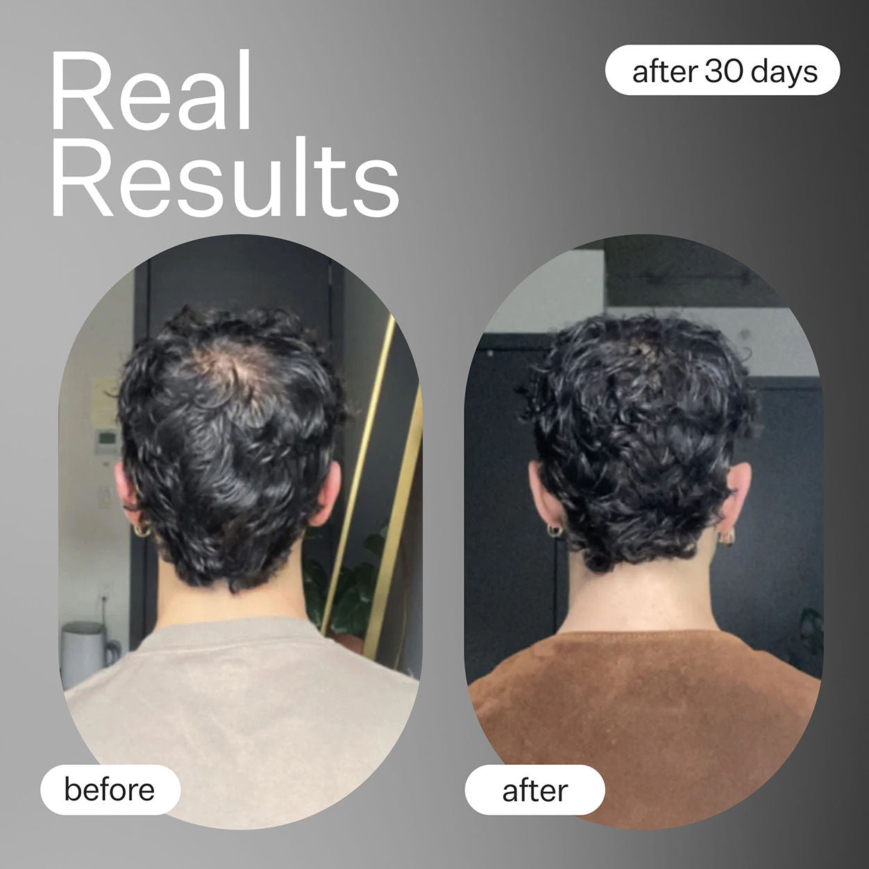 Natural Plant-Based Hair Growth Capsules - Cold Processed for Maximum Nutrient Retention | Supports Stronger, Healthier Hair for Men & Women | Perfect for Daily Hair Care Routine
