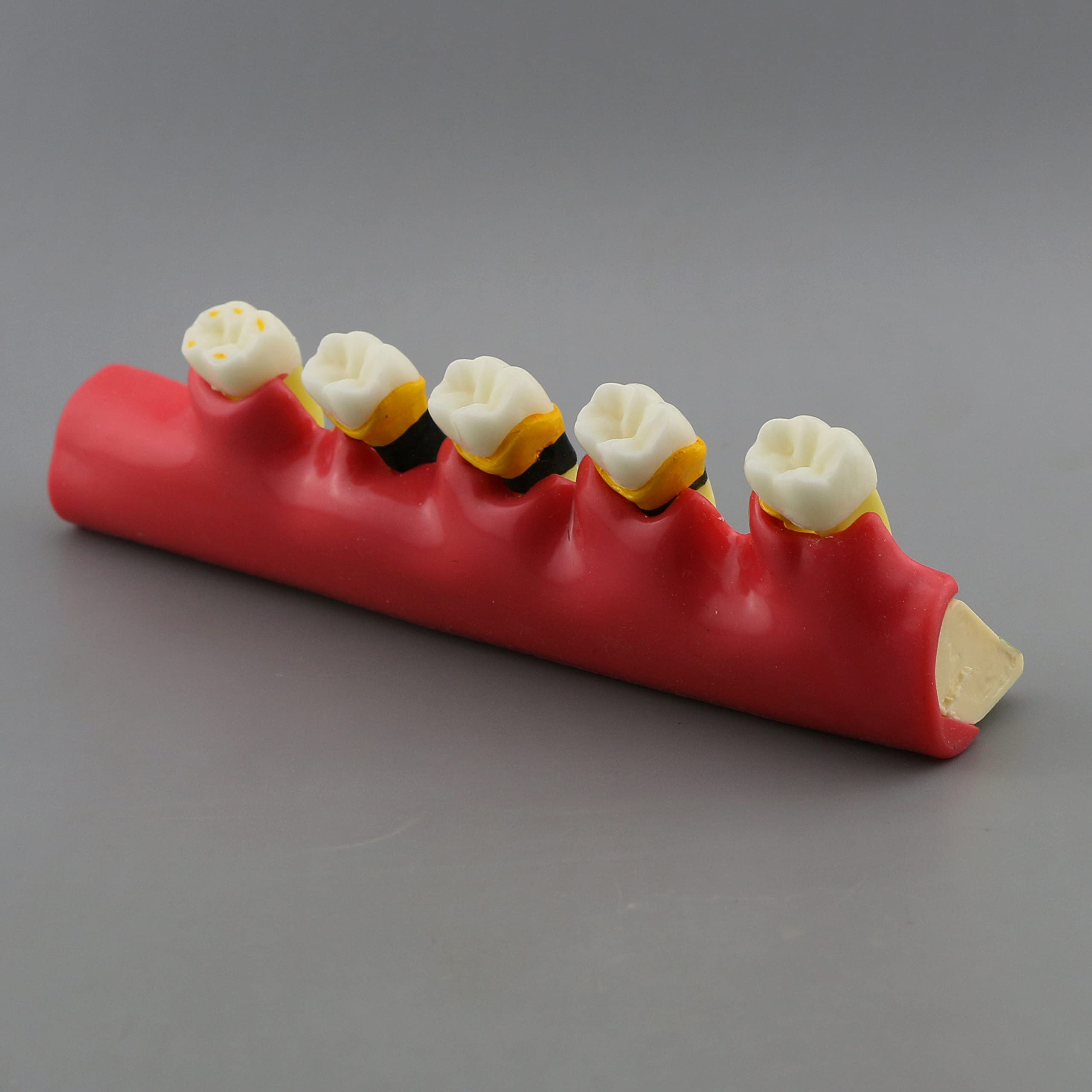 Dental Typodont Teeth Model for Adults & Children - Pathological Demonstration for Teaching & Studying (M4010) | Ideal for Dental Schools, Training & Clinical Practice