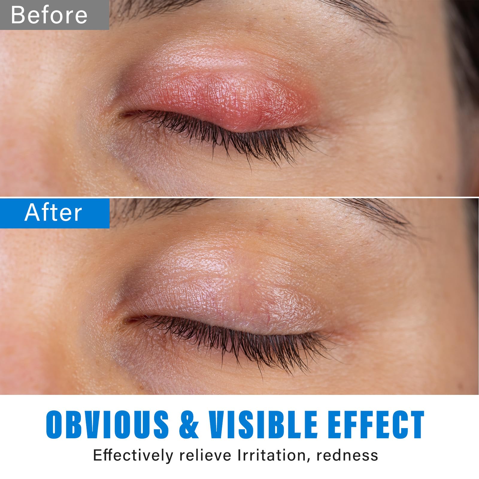 Stye Eye Treatment Serum for Styes, Chalazion & Blepharitis | Gentle Lash & Eye Cleanser (30ml) | Soothes Irritation & Promotes Healing | Perfect for Daily Eye Care & Eyelid Hygiene