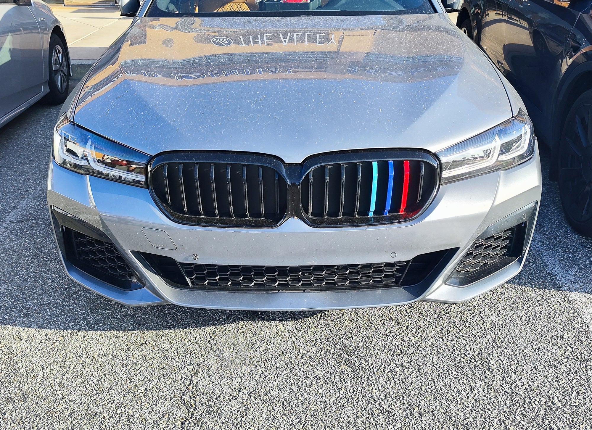 BMW G30 G31 5 Series M Style Color Grille Inserts (2021+) - 8 Beam Design for Enhanced Style & Sporty Look | Perfect for Car Enthusiasts & Custom Upgrades