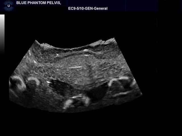 General Pathology Transvaginal Ultrasound Training Model - High-Quality Medical Simulation for OB/GYN Education & Clinical Practice - Perfect for Medical Schools, Hospitals & Diagnostic Labs