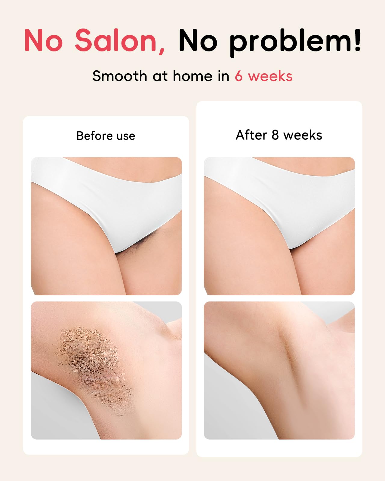 LYSMOSKI IPL Hair Removal Device for Women & Men - Painless & Safe At-Home Laser Hair Remover for Face, Legs, Arms, Bikini Line & Body - Permanent Hair Reduction for Smooth Skin at Home & Travel