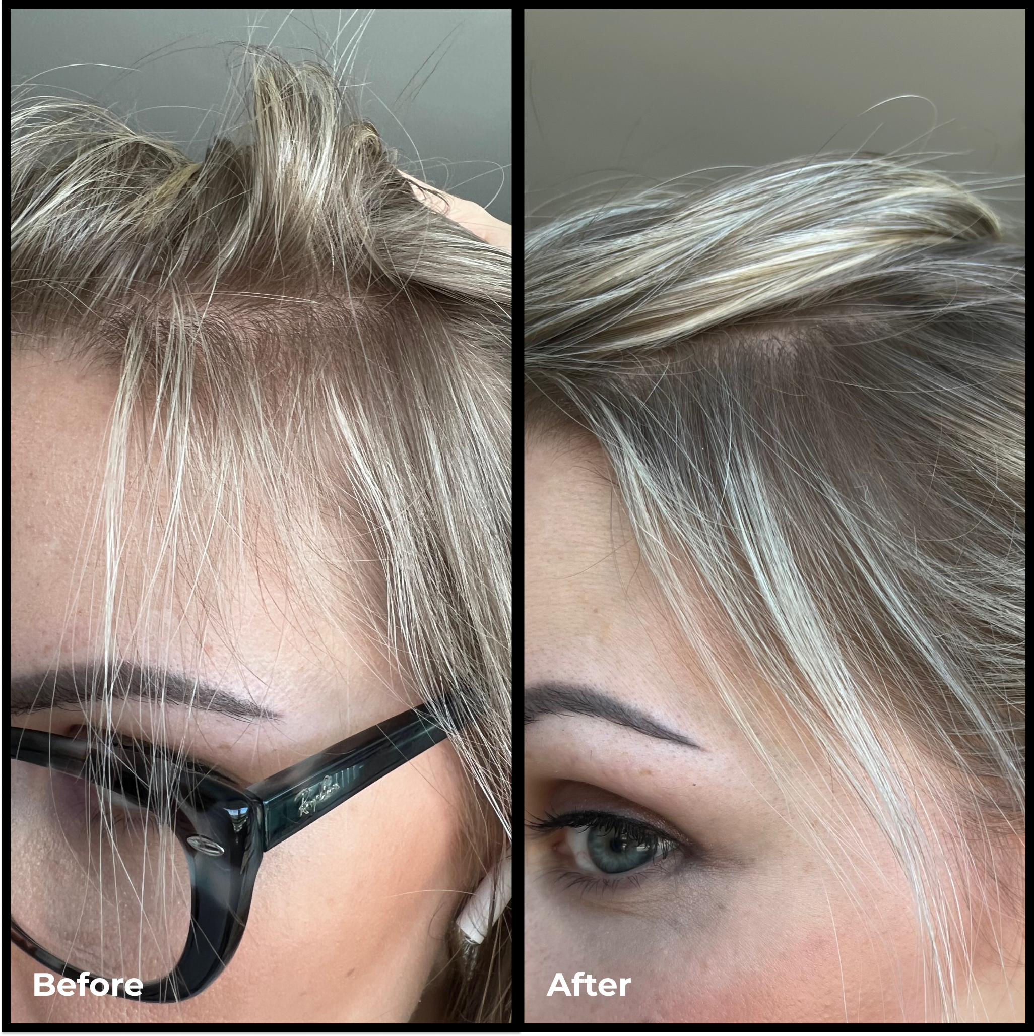 Better Roots RootBoost Serum - Hair Growth Treatment for Thicker, Fuller Hair | Natural & Organic Formula | Perfect for Thinning Hair & Scalp Health | Use Daily for Best Results