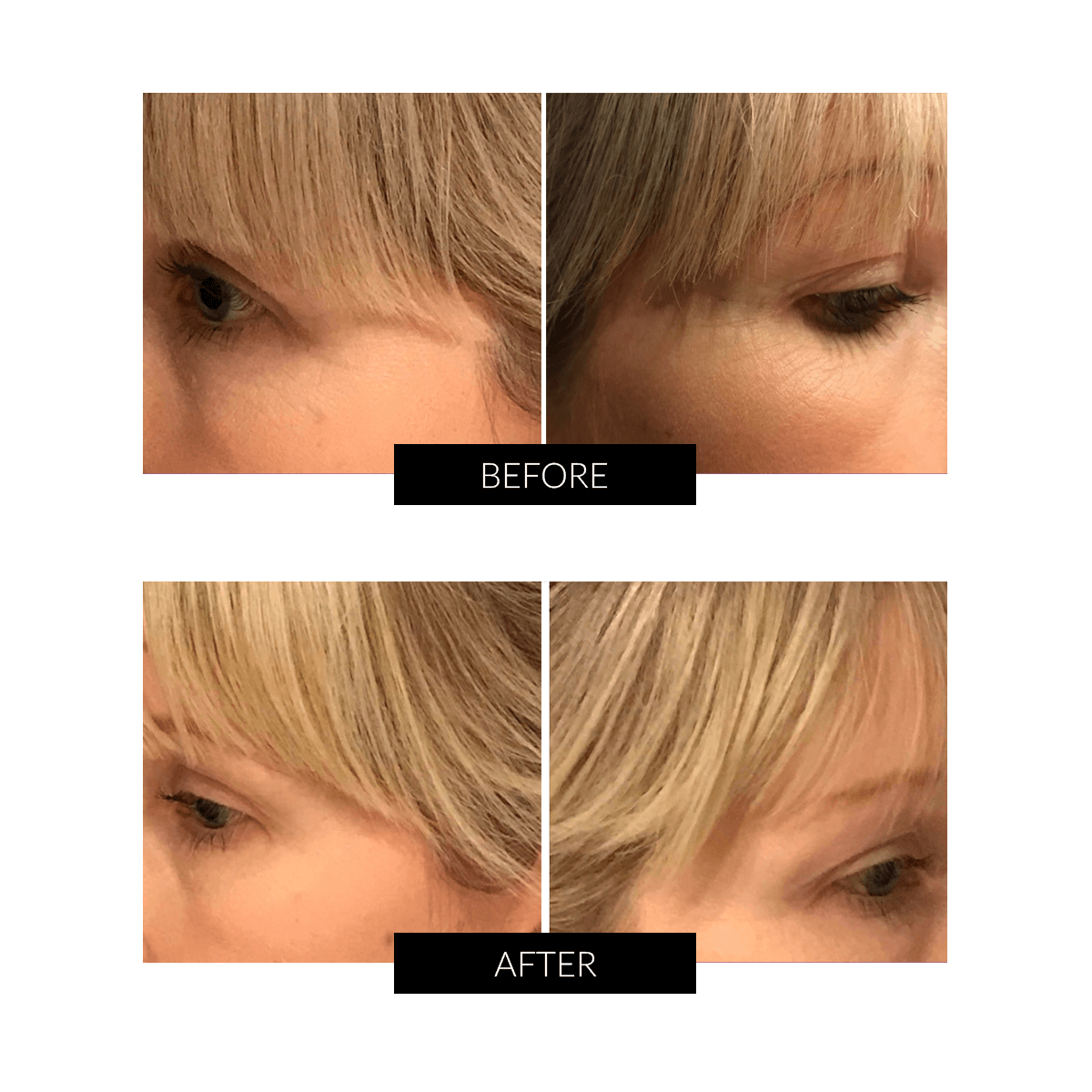 OXYjet GO Oxygen Facial System - Professional At-Home Skincare Device for Glowing Skin | Perfect for Anti-Aging & Hydration Treatments